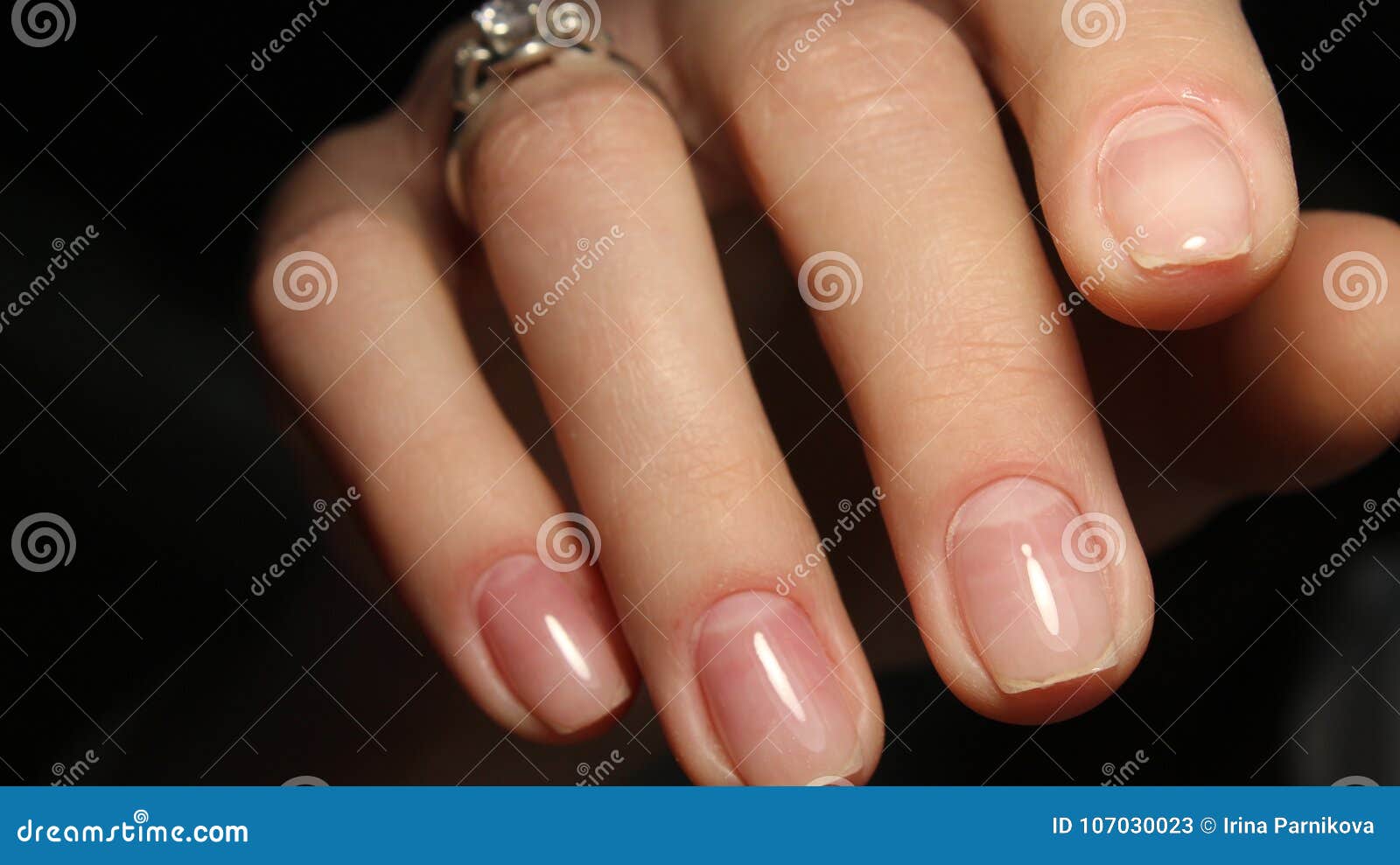 Vitamins for Nails: Finger Nails speak a lot about your health