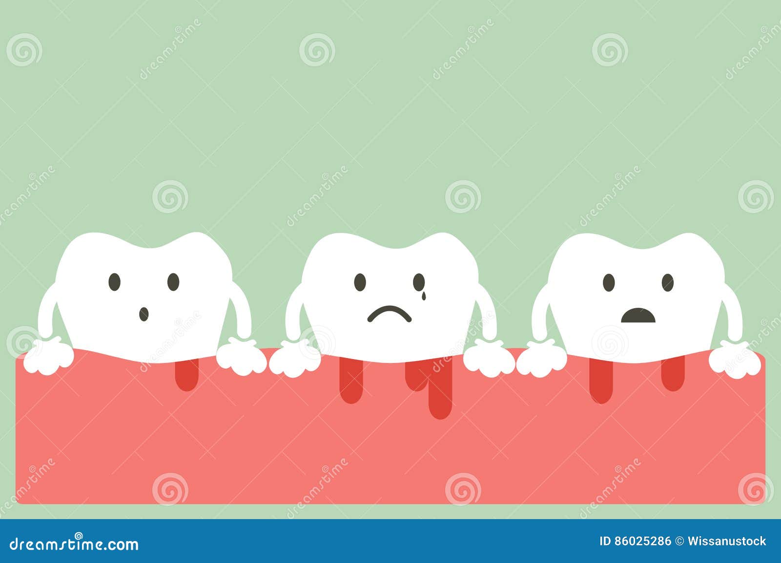 Gingivitis and bleeding stock vector. Illustration of dentist 86025286