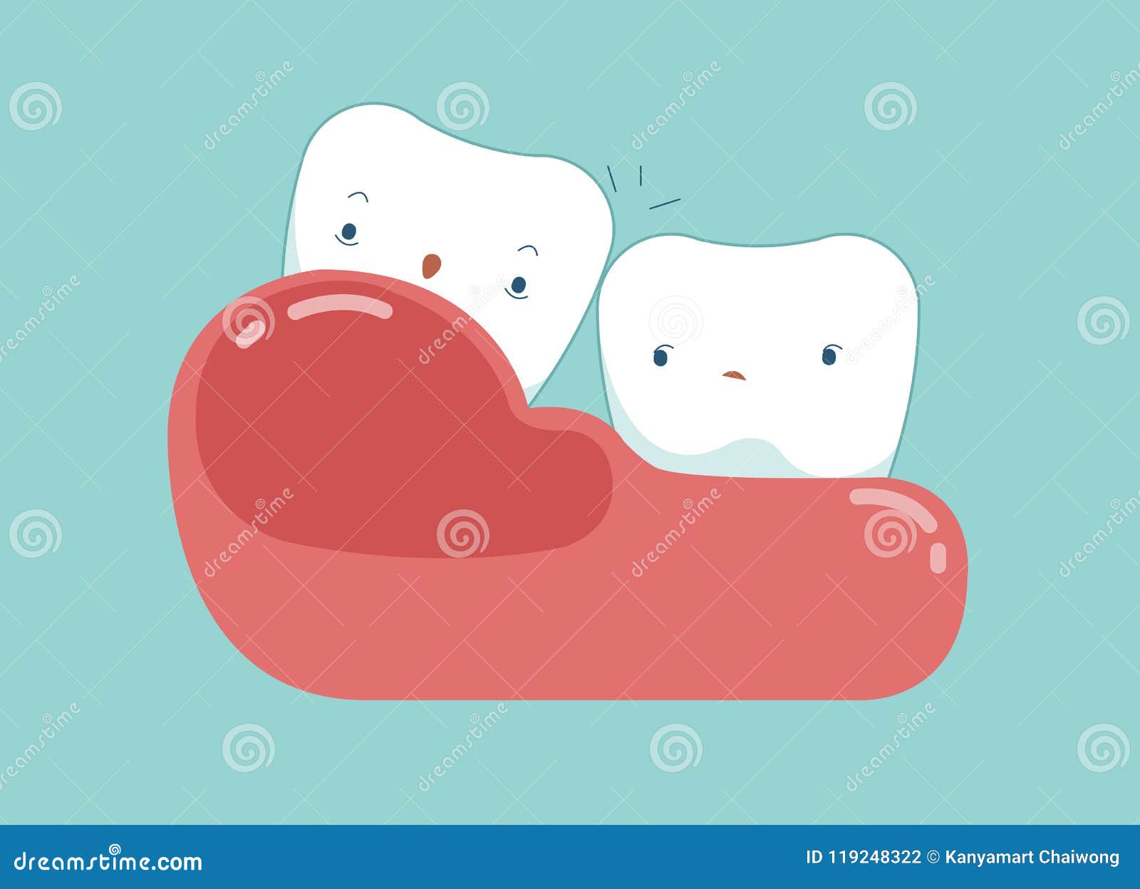 gingivitis of dental .