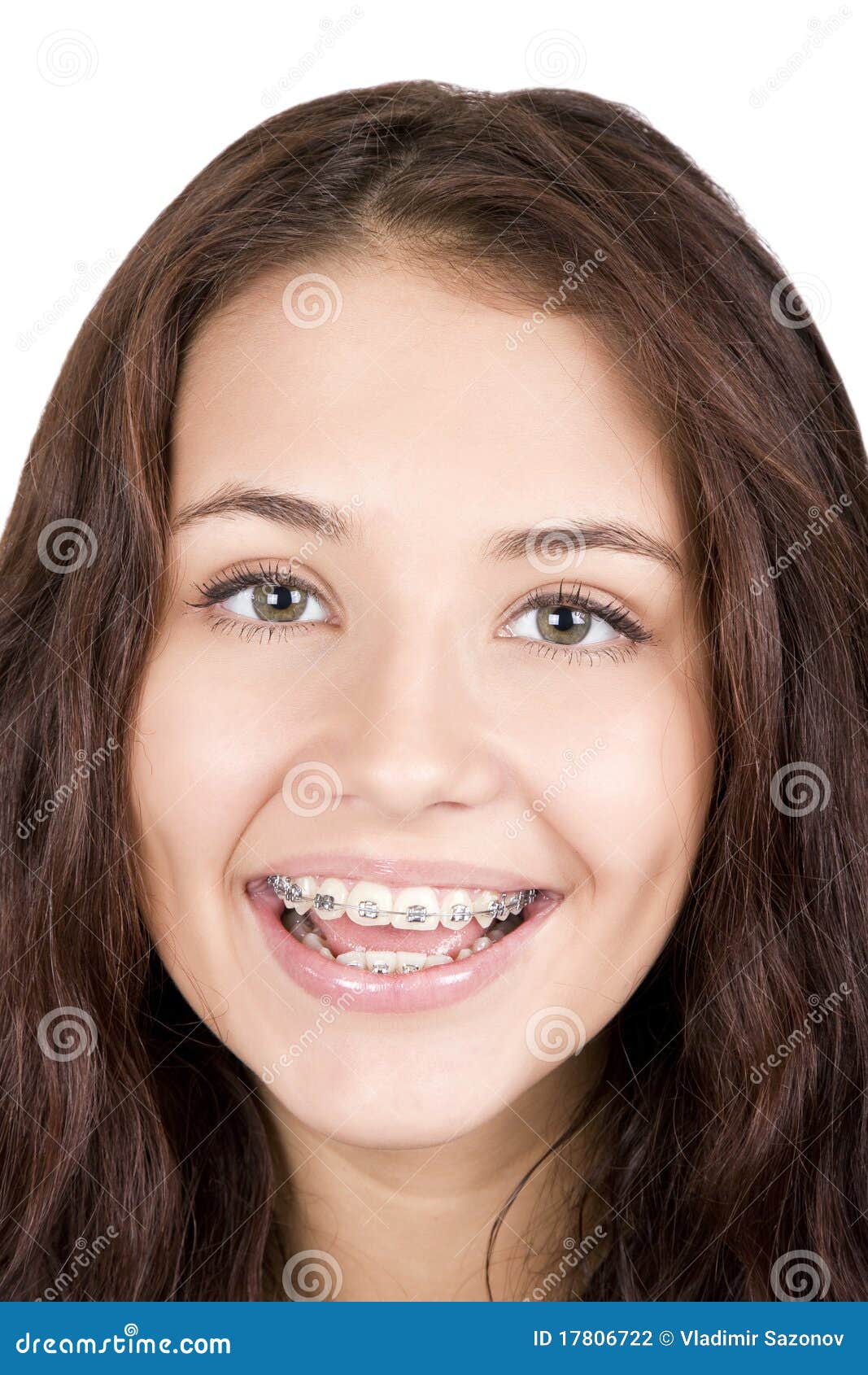 Girl with braces stock photo. Image of teenager, 17806722