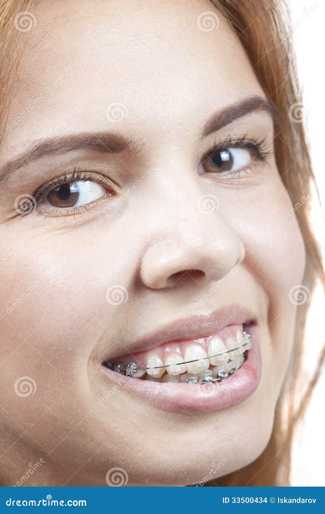 Young Girls With Braces On Teeth