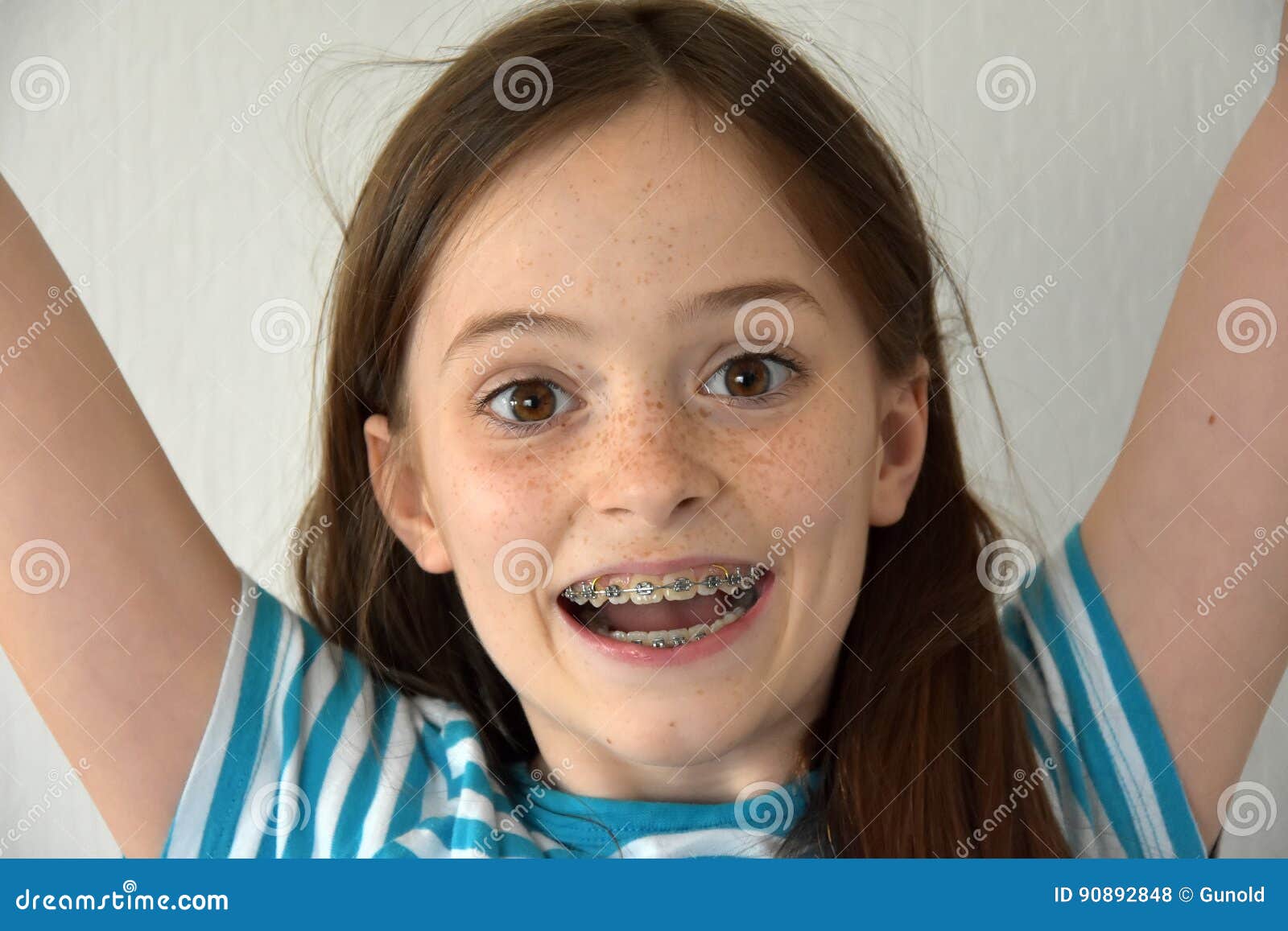 teeny teen with braces