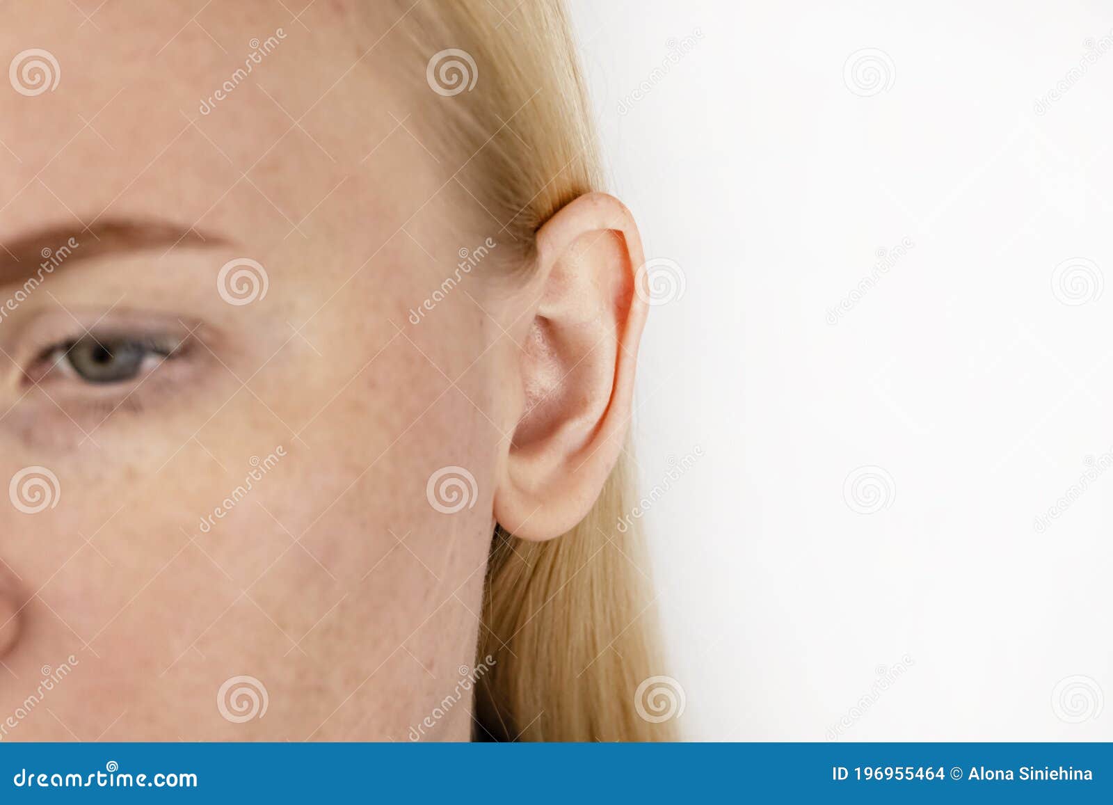darwin`s tubercle on the ear. the girl at the reception at the plastic surgeon, shows the auricle