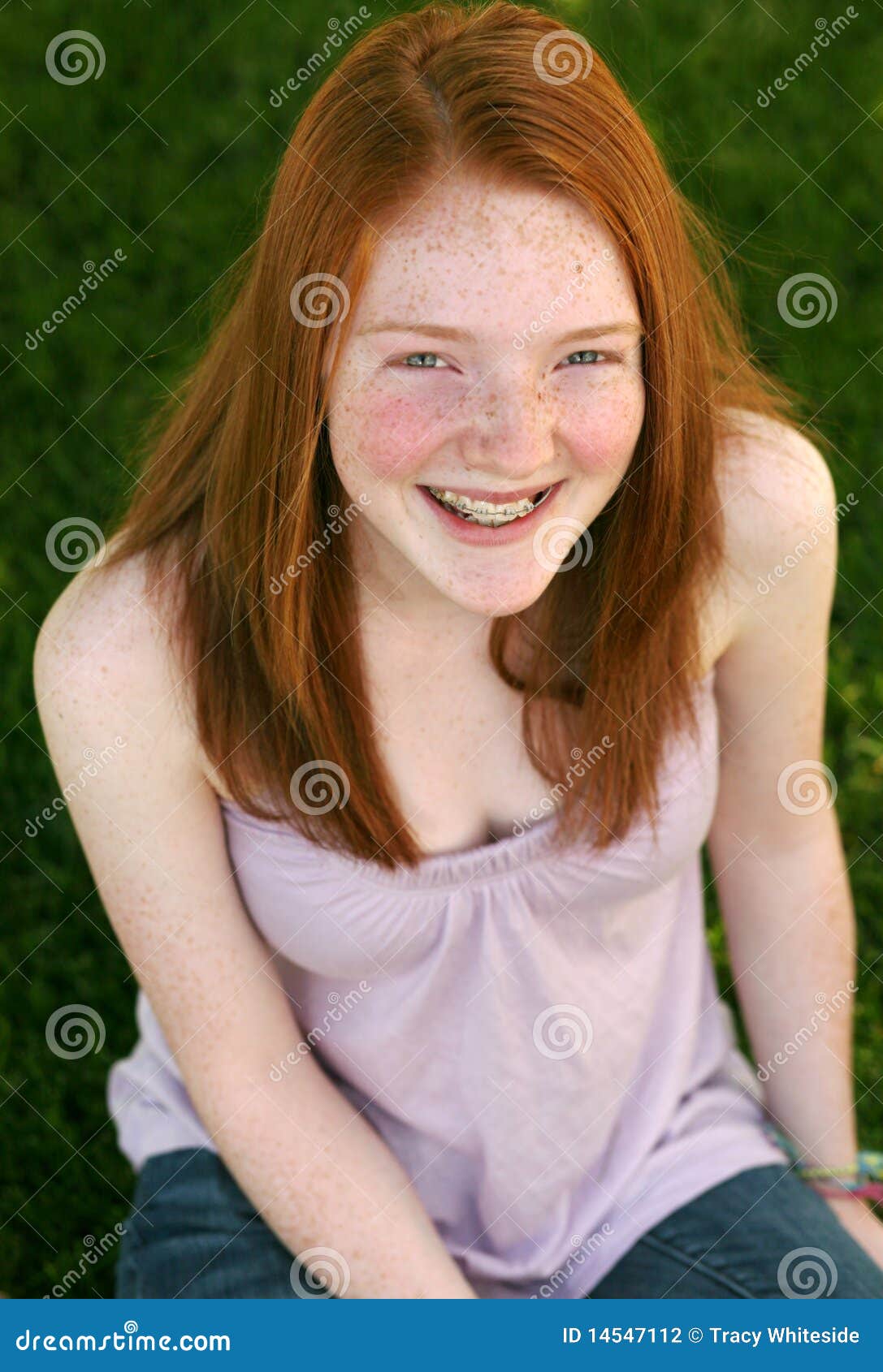 Redheads With Braces