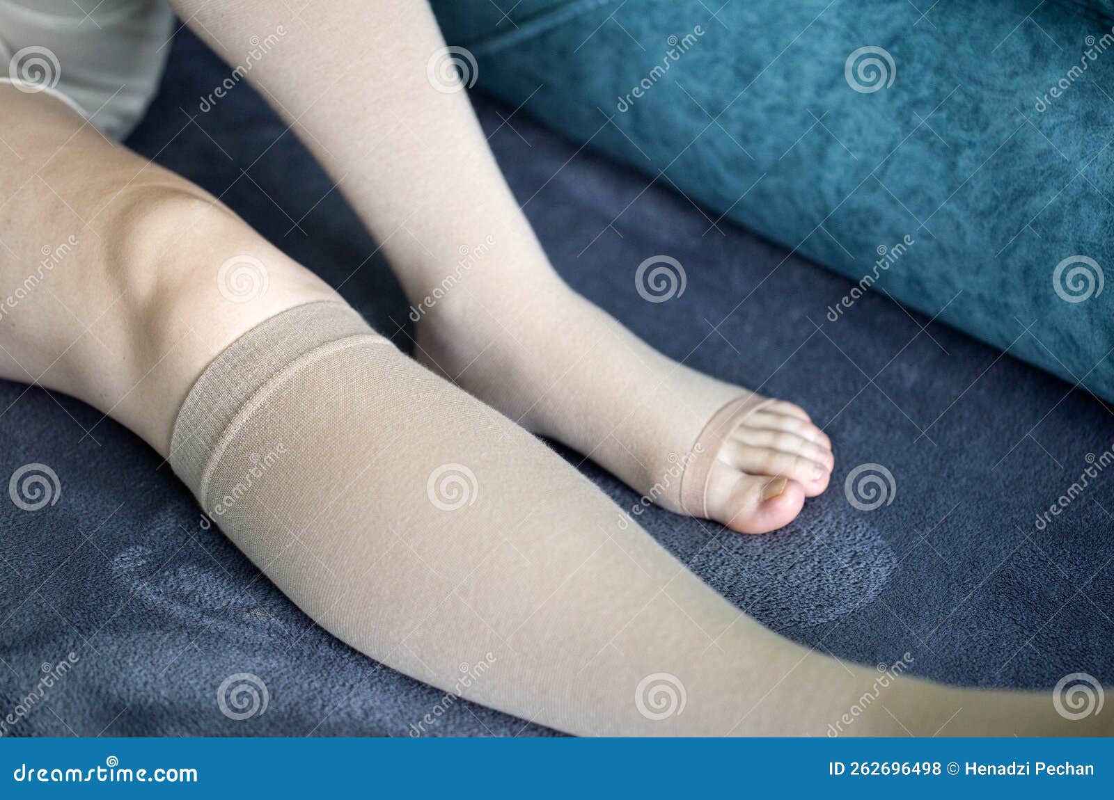 Girl`s Legs in Compression Stockings for Varicose Veins. Pregnancy and Varicose  Veins Legs of a Girl at Home on the Sofa. Pain an Stock Photo - Image of  clots, puffiness: 262696498