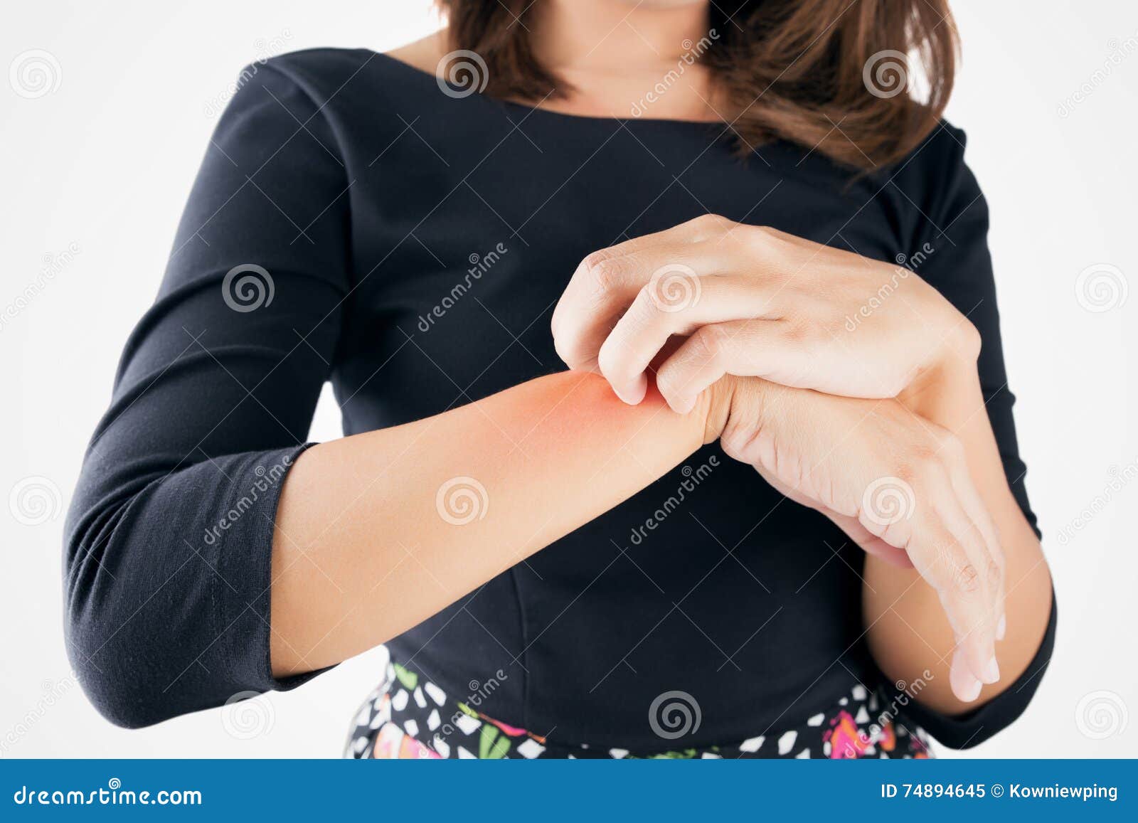 girl scratch the itch with hand. itching, concept with healthcare and medicine.