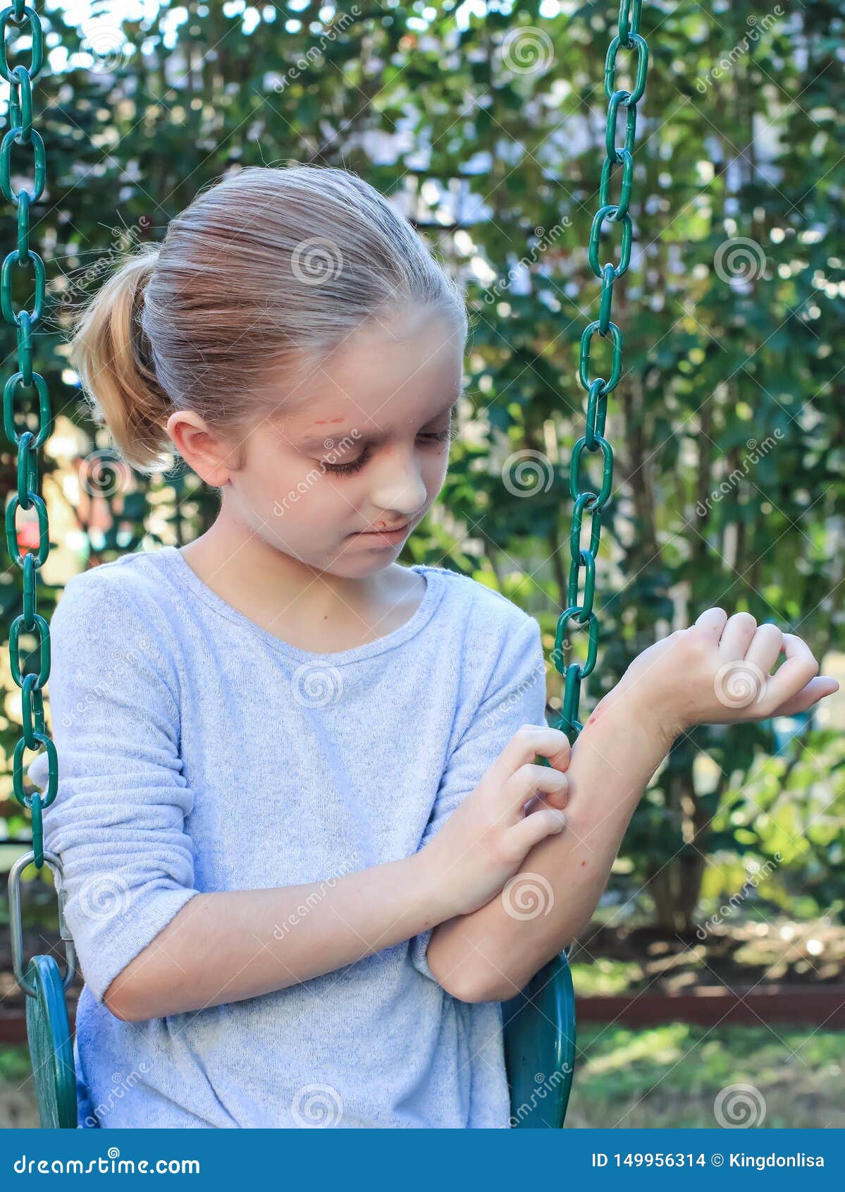 girl scratching itchy eczema on swing