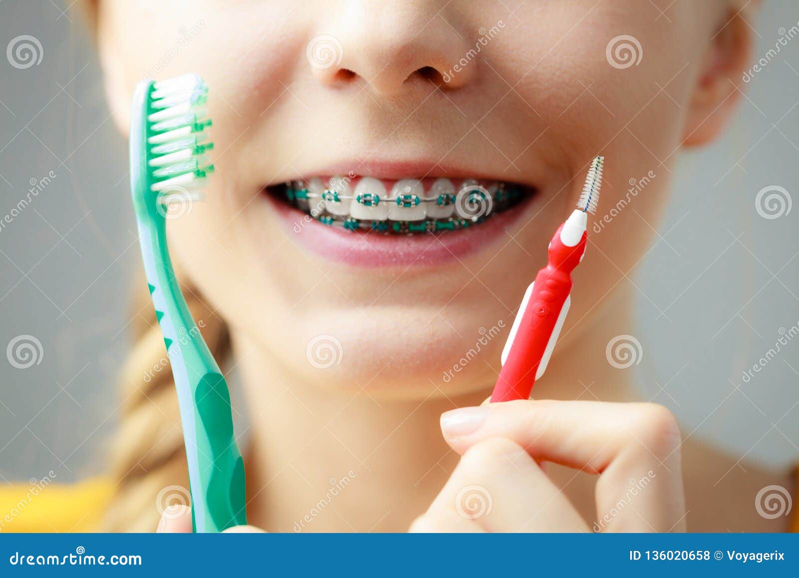 Girl With Teeth Braces Using Interdental And Traditional Brus