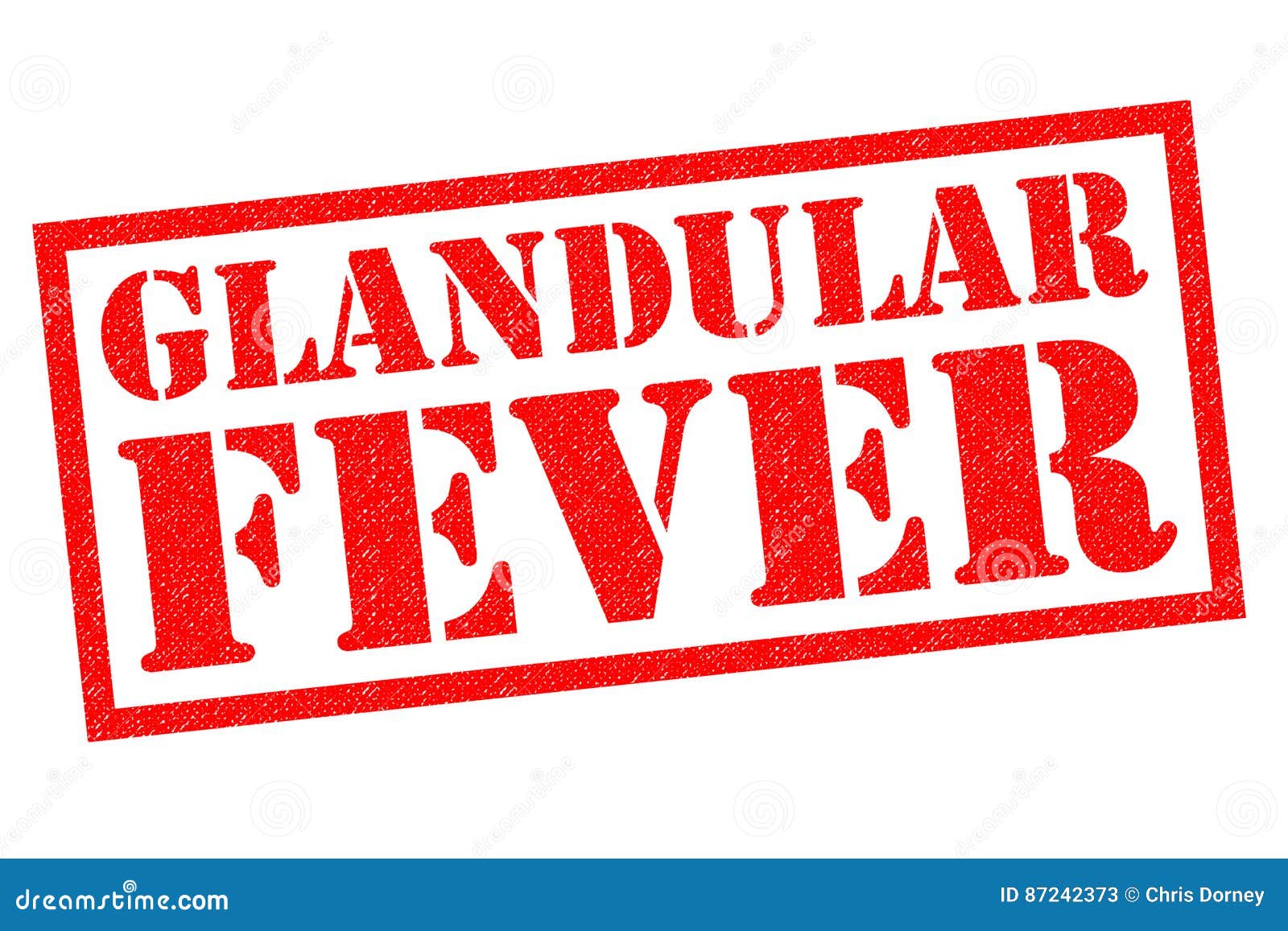 GLANDULAR FEVER stock illustration. Illustration of background 87242373