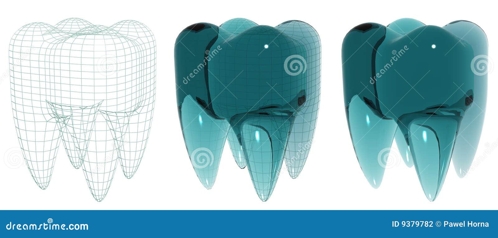 Glass tooth stock illustration. Image of prosthetics, mesh 9379782