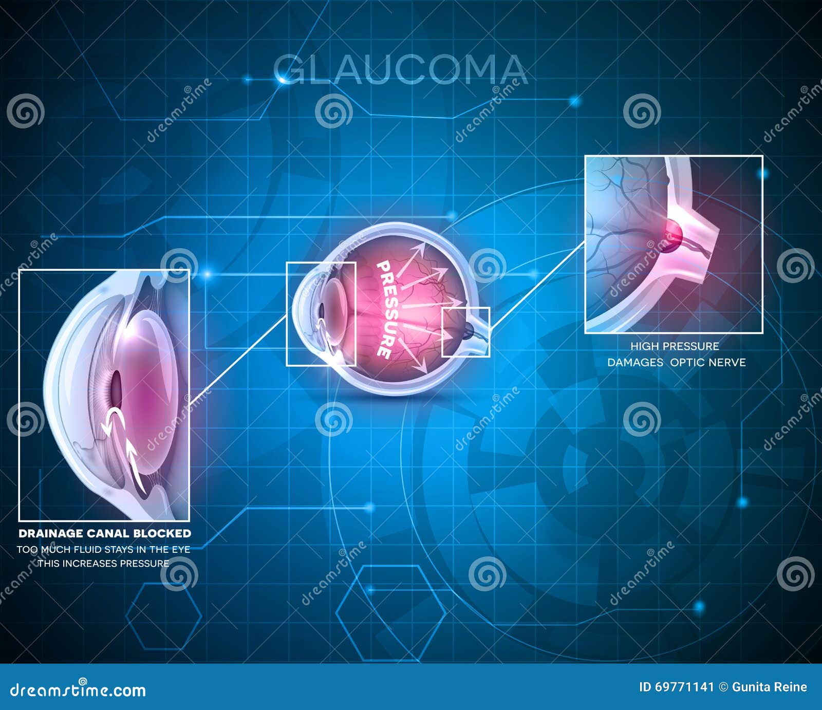 stock vector. Illustration of diagram, care 69771141