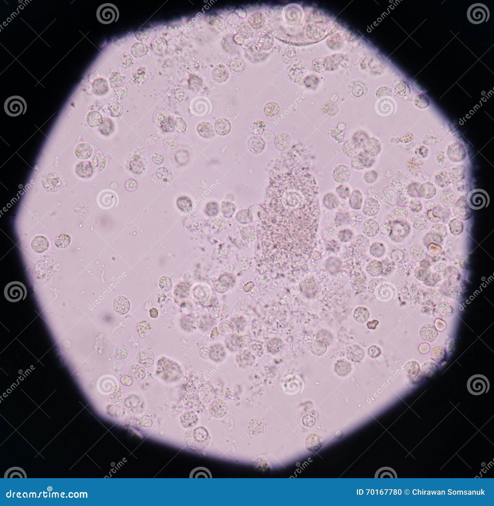Globules Blancs Modérés, Globules Rouges, Cellules De Bactéries Dans L