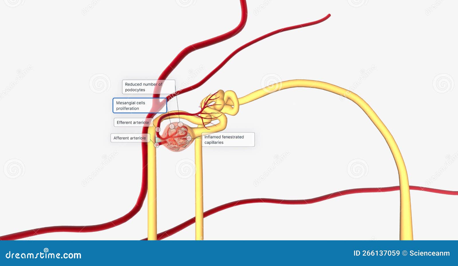 Glomerulonephritis is a Group of Renal Conditions Characterized by