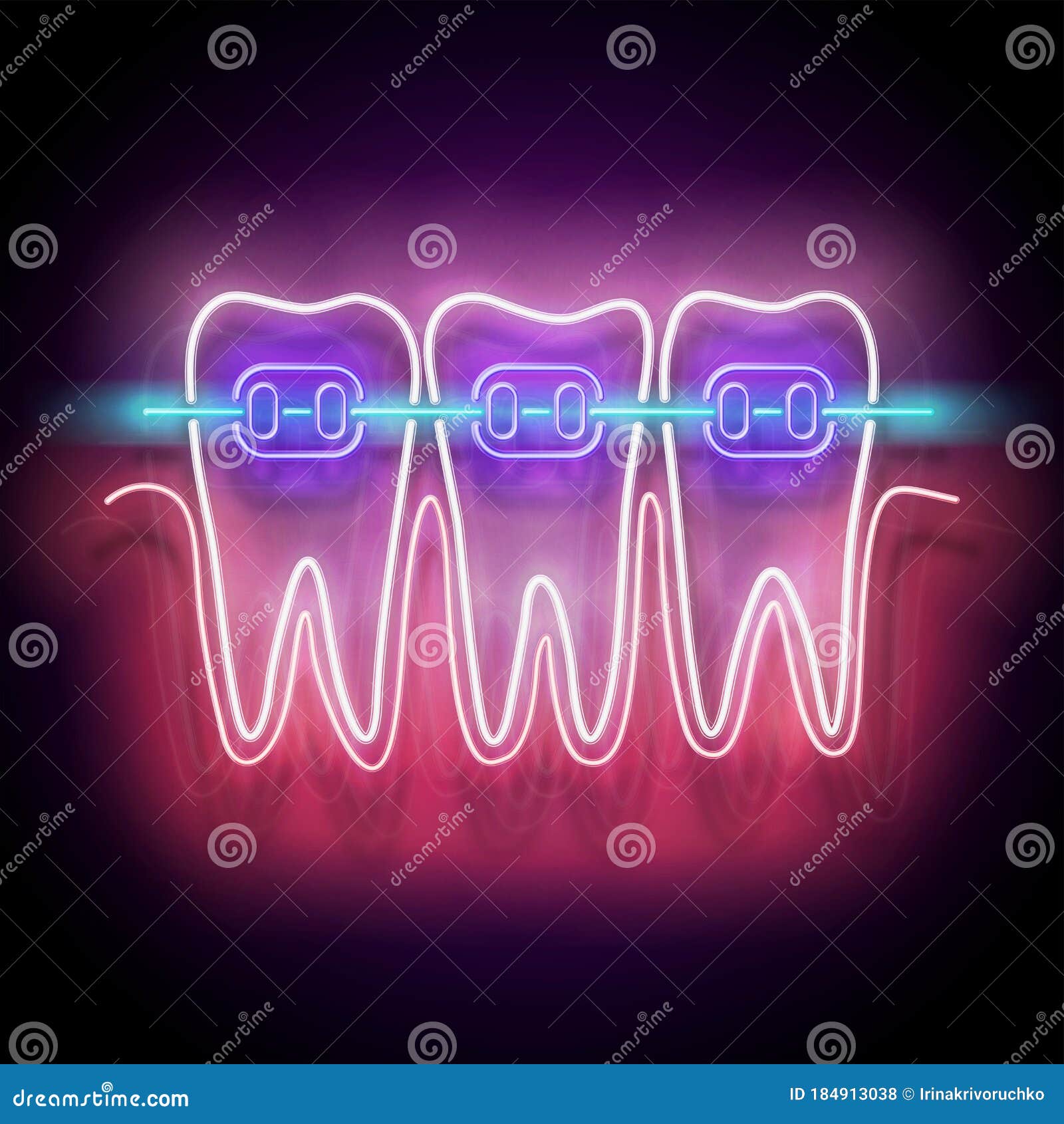glow dentition with white teeth and braces
