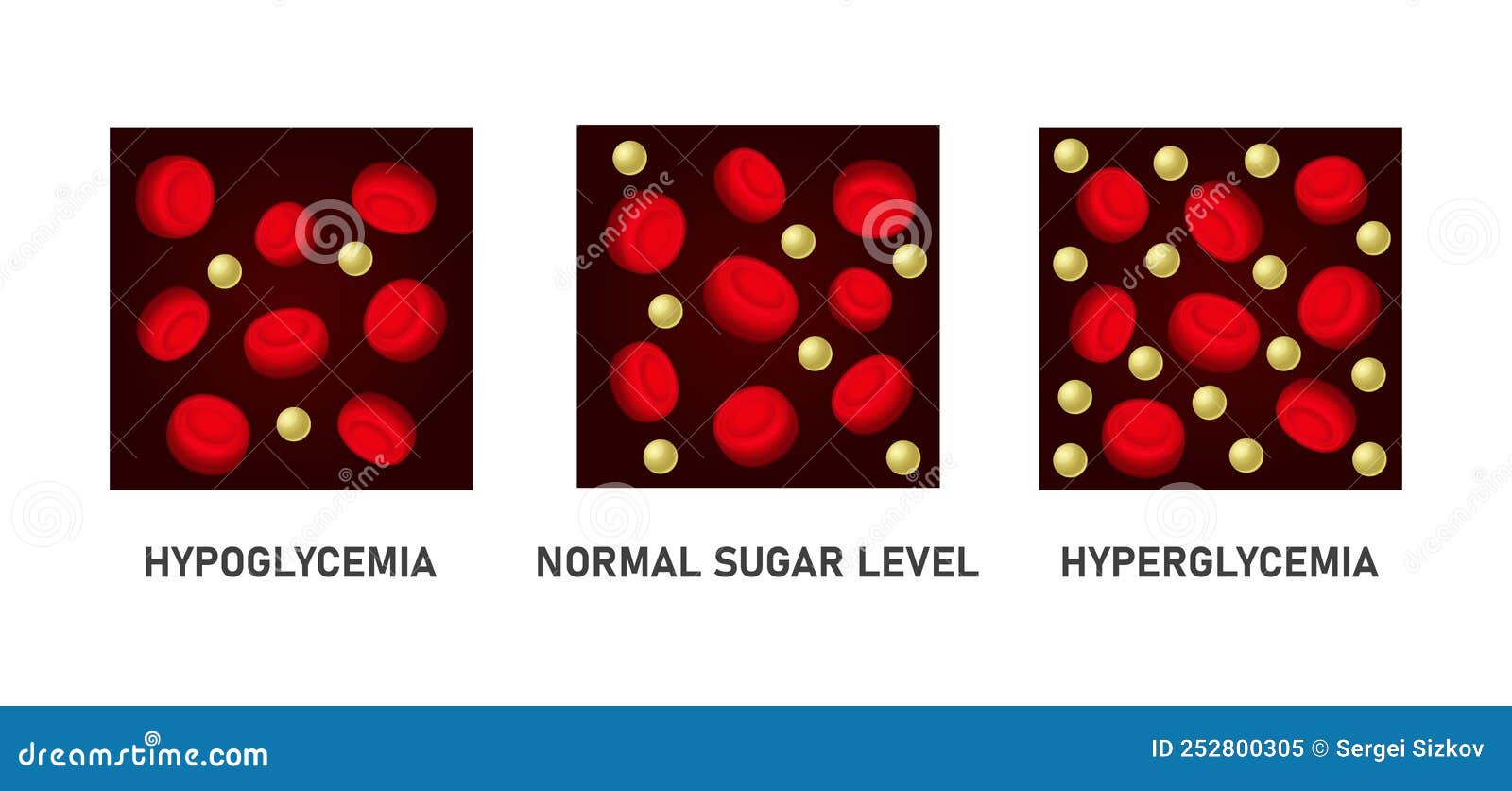 glucose blood sugar level set. hypoglycemia and hyperglycemia icons. 