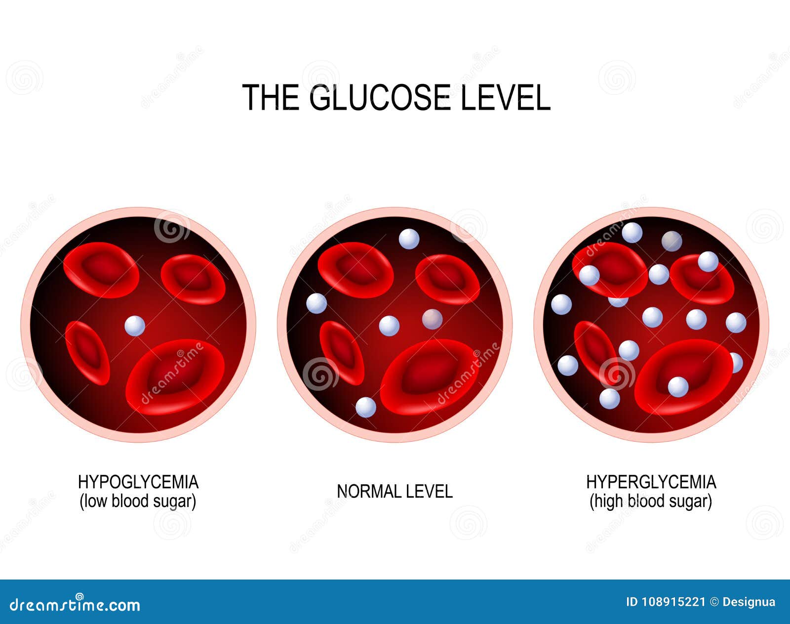 hypoglycemia blood glucose test Illustrations Glucose Vector & Stock Images Cartoons, hypoglycemia blood glucose test Illustrations Glucose Vector & Stock Images Cartoons,