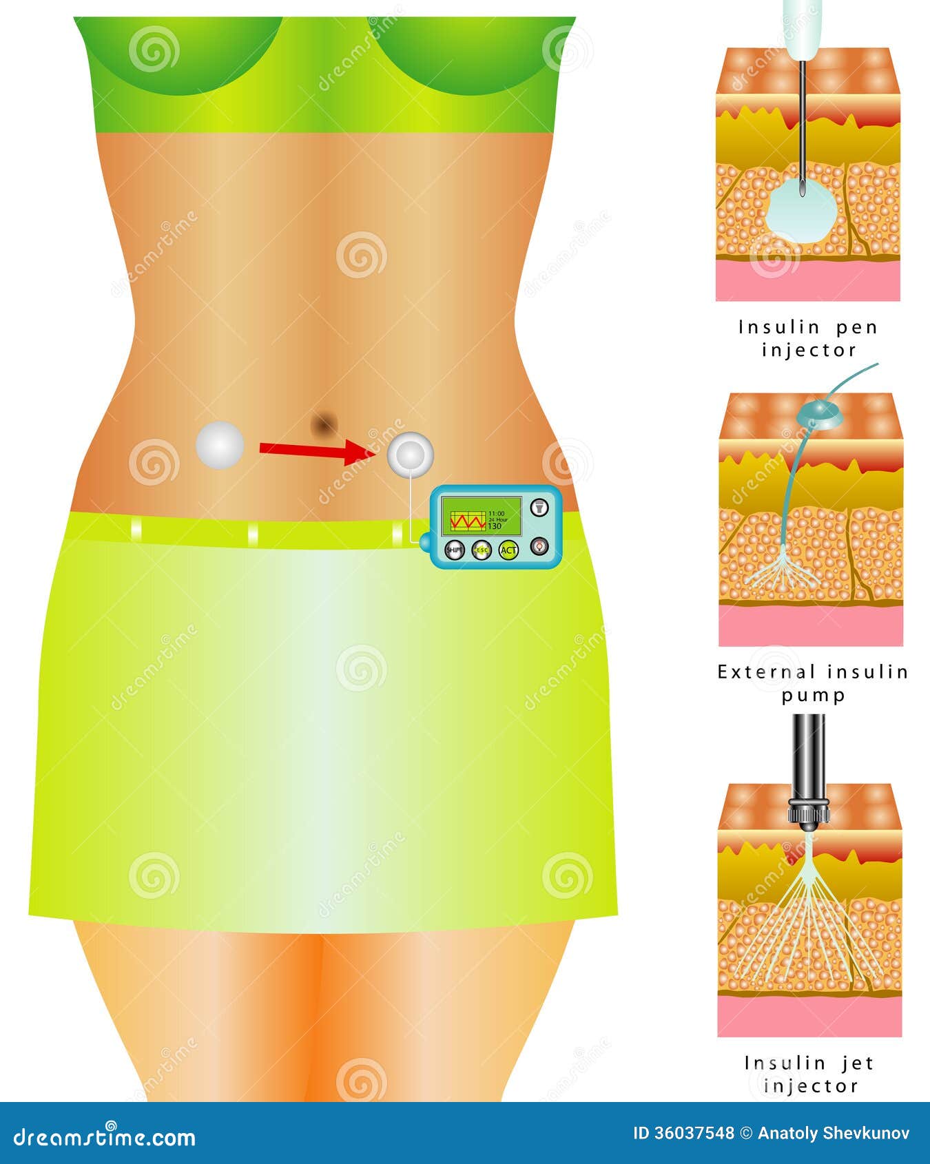 glucose-monitoring-stock-vector-illustration-of-care-36037548