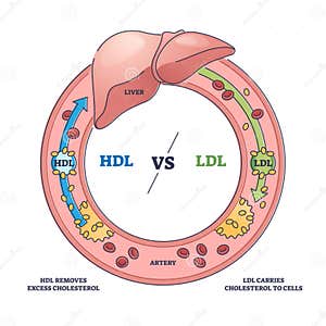 Good HDL And Bad LDL Cholesterol Movement Comparison Outline Diagram 