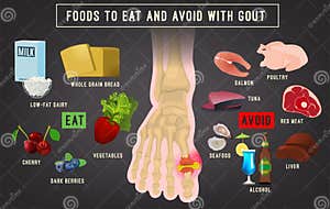 Gout Arthritis Icon Vector Illustration CartoonDealer 159083456