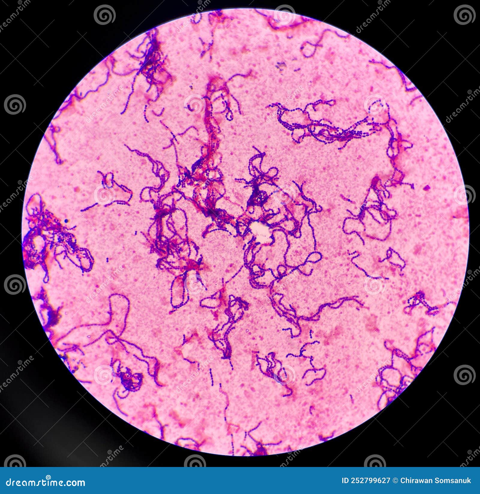 Gram Negative Rods In Chains
