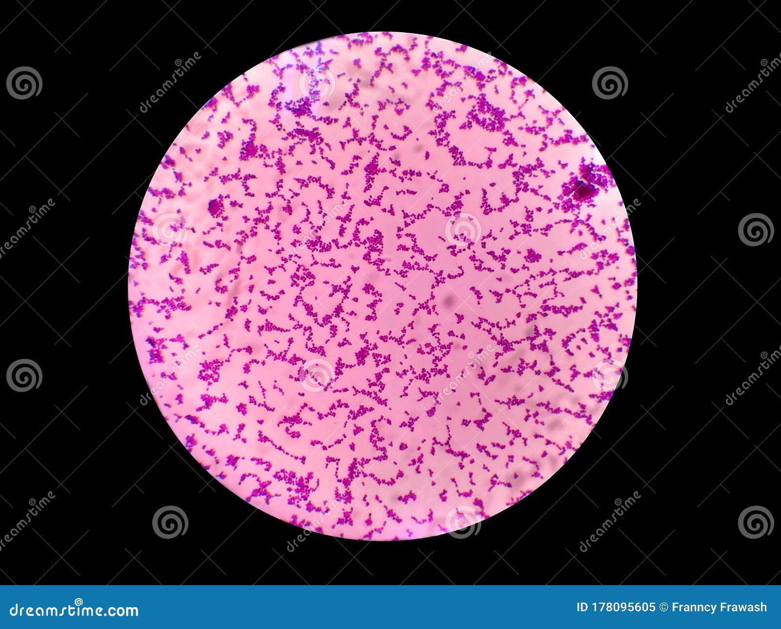 Cocci gram positive Staphylococcal Infections