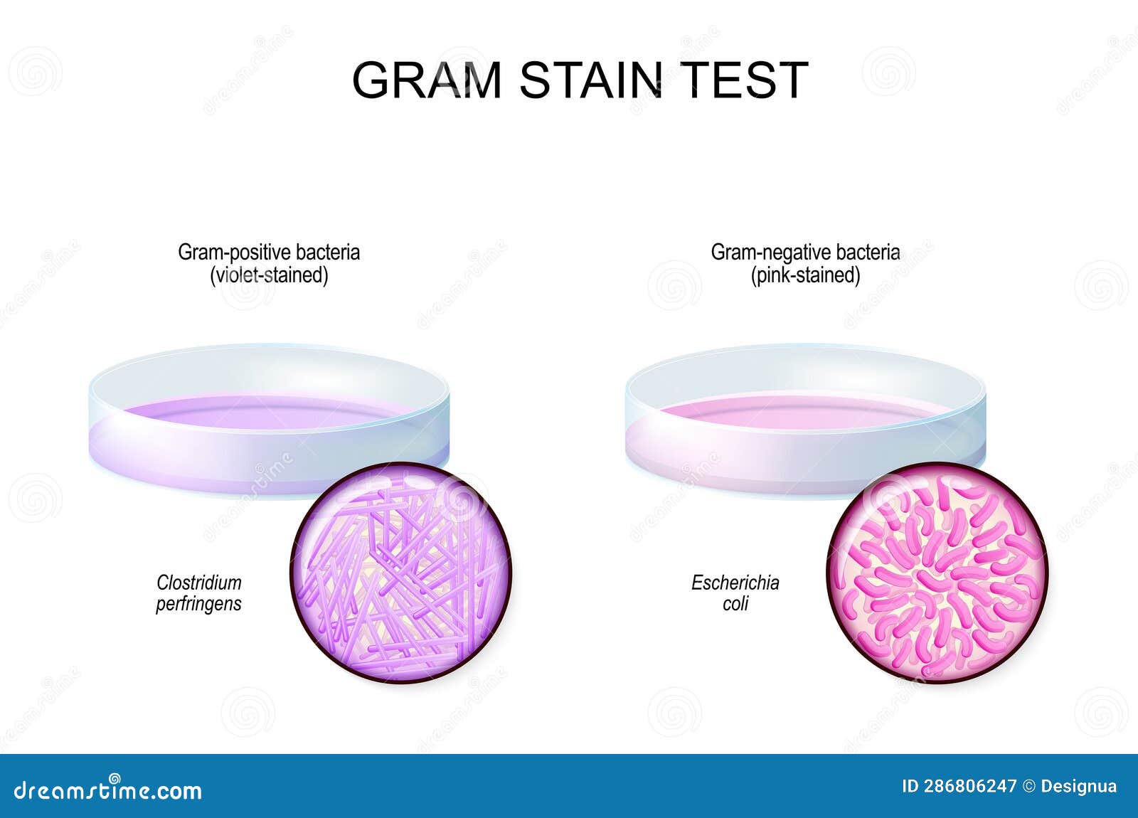Gram Stain Test. Glass Petri Dish with Culture Gramnegative and Gram
