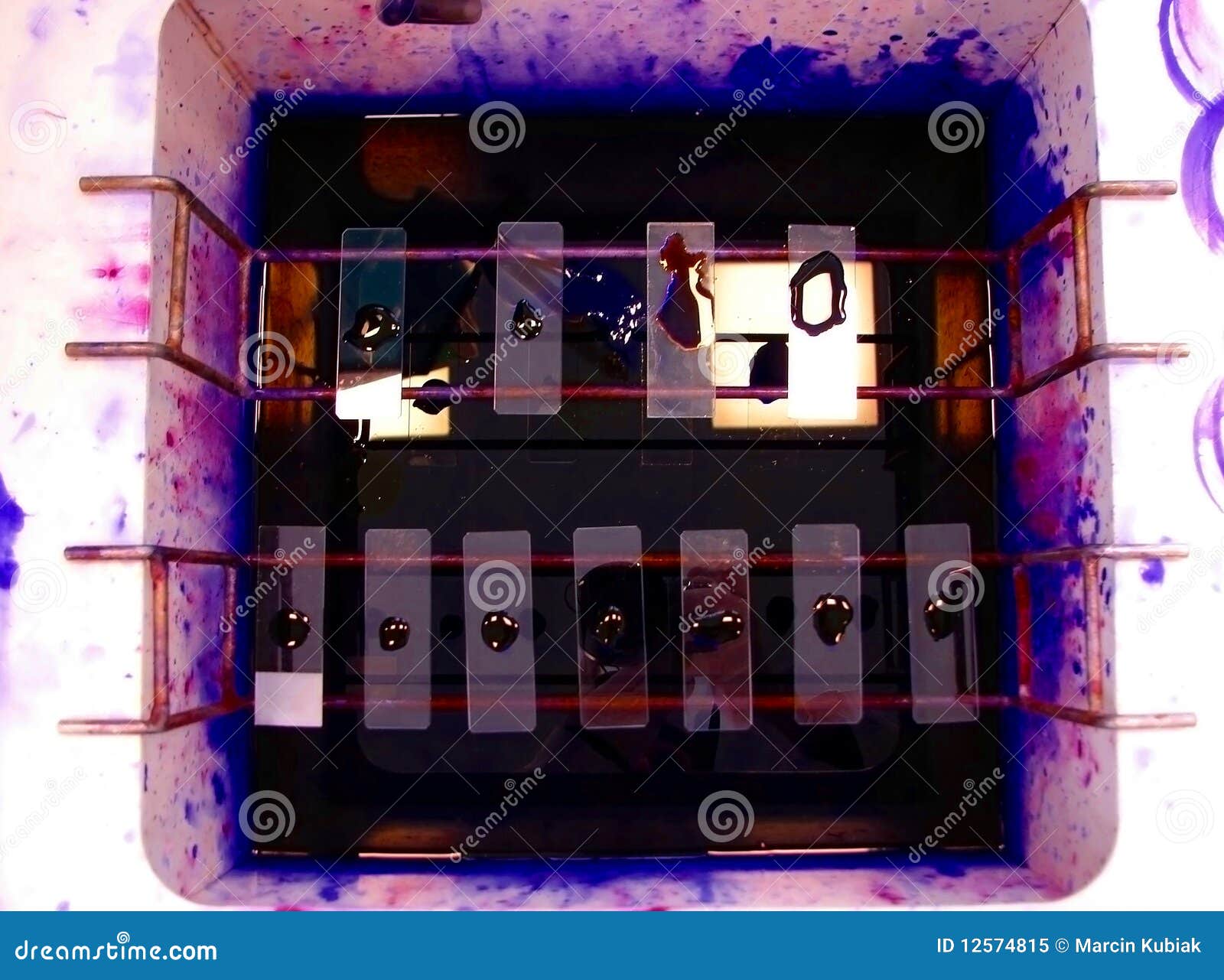 gram staining