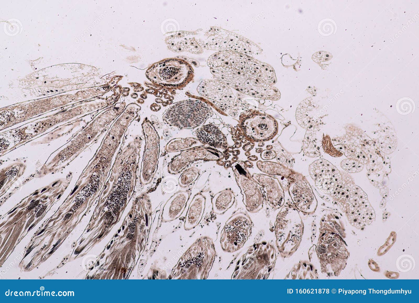 grasshopper testis dissection