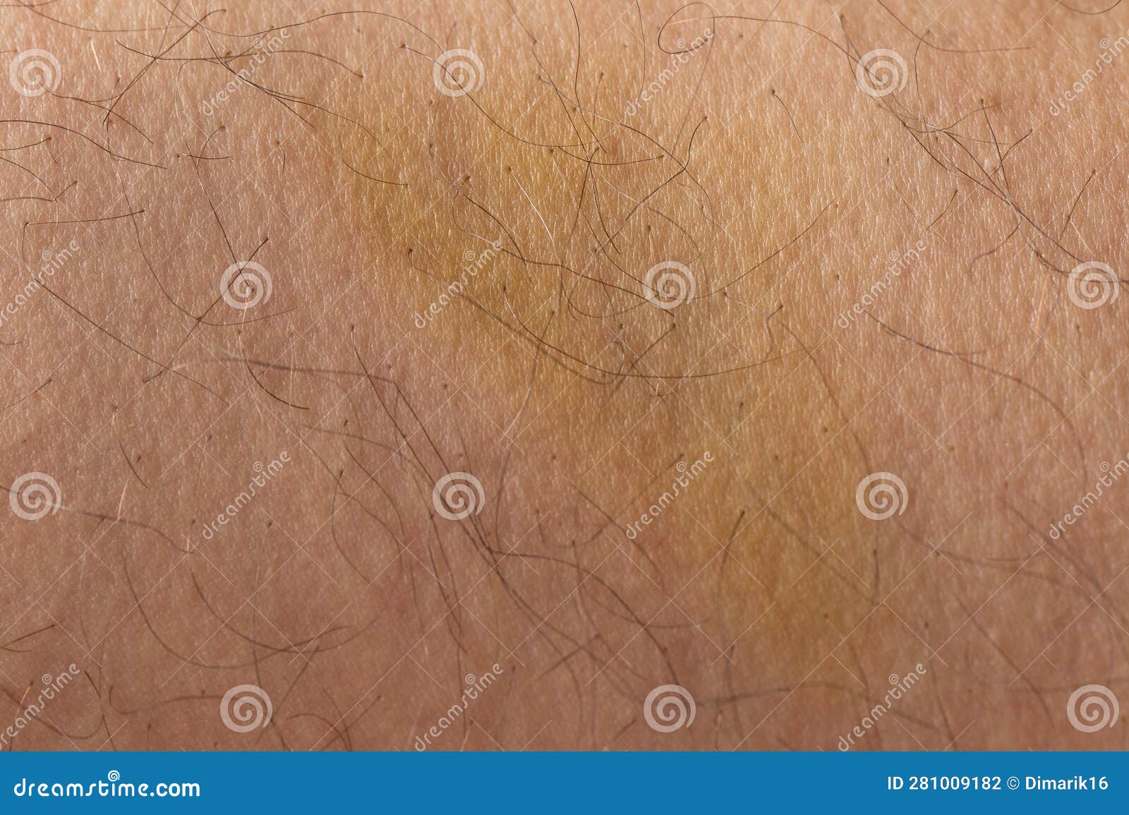 Green bruise on human skin stock photo. Image of spot 281009182
