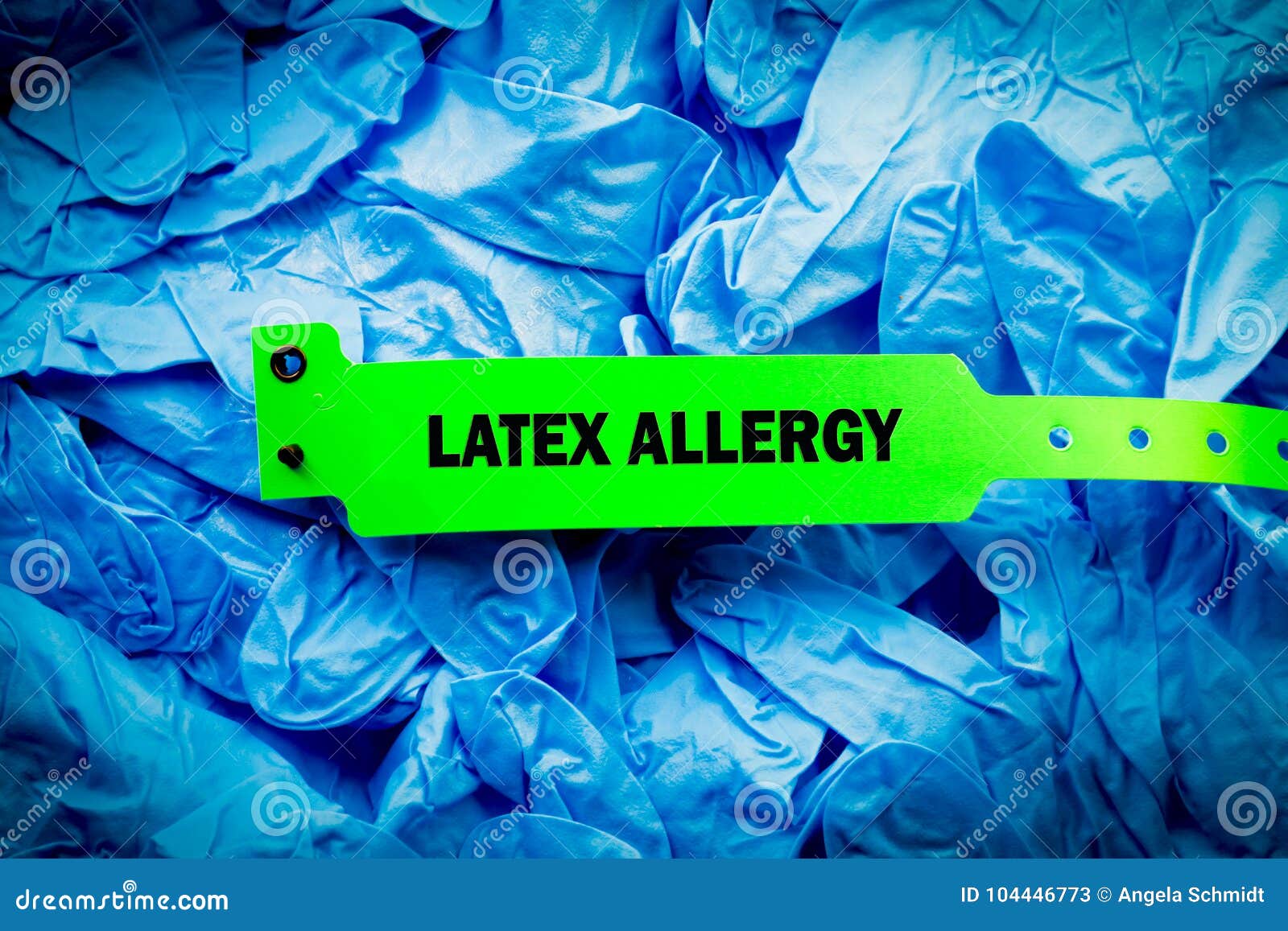 Latex Allergy Rash stock image Image of hand immunization  36243311