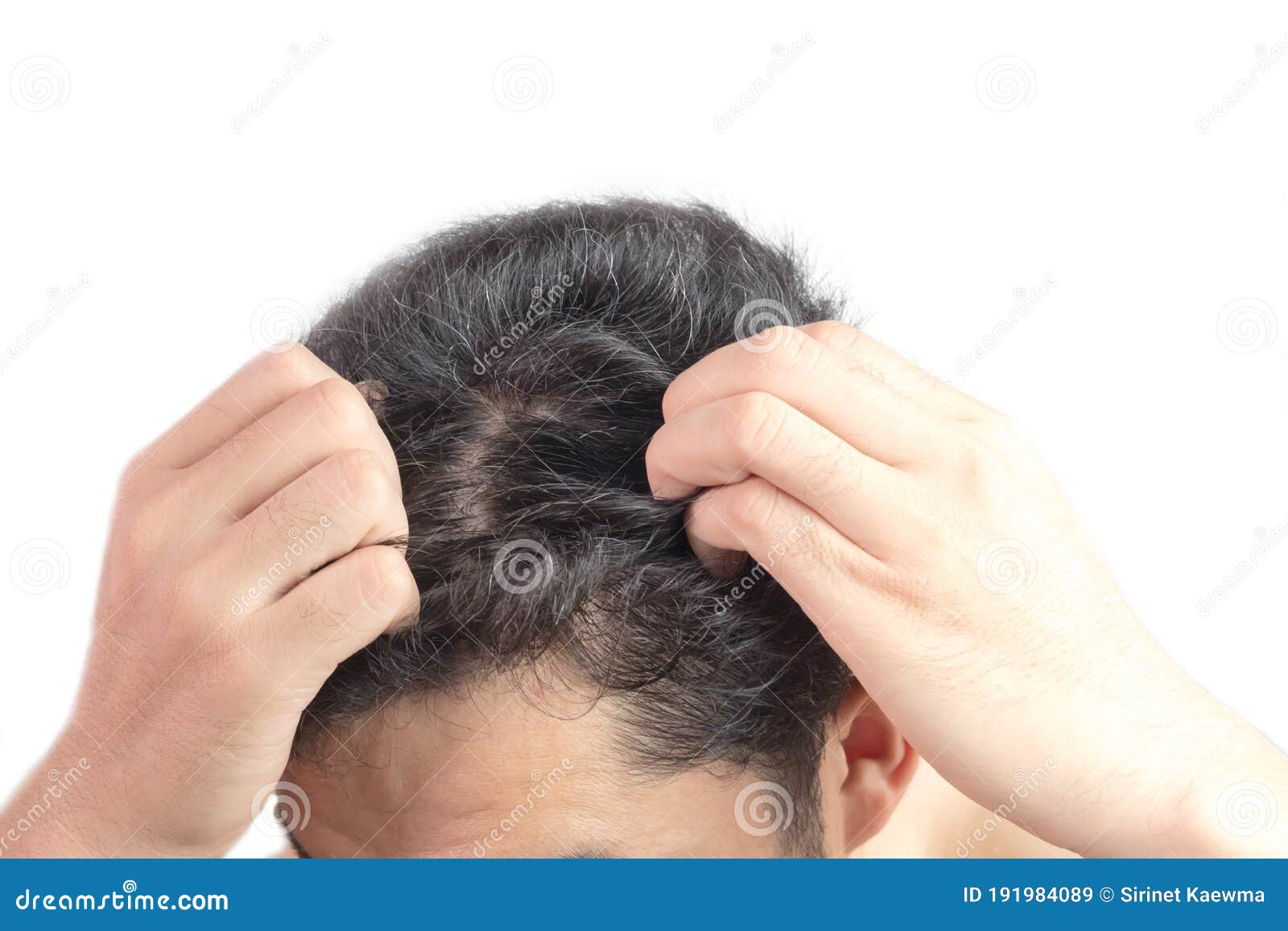 Grey Hair on Theyoung Man Head. Hair Dye Product Concept Stock Image -  Image of beauty, adult: 191984089