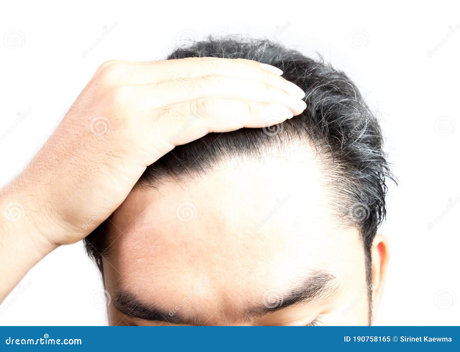 Grey Hair on Theyoung Man Head. Hair Dye Product Concept Stock Image - Image of medical, female: 190758165 Grey Hair on Theyoung Man Head. Hair Dye Product Concept Stock Image - Image of medical, female: 190758165