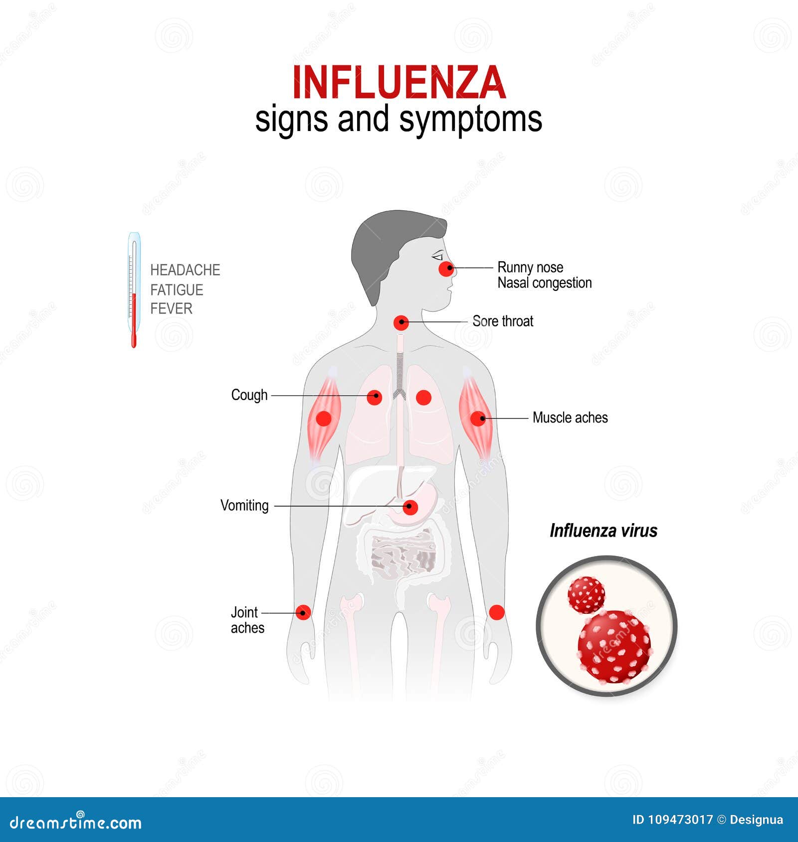 Grippe Zeichen Und Symptome Vektor Abbildung Illustration von
