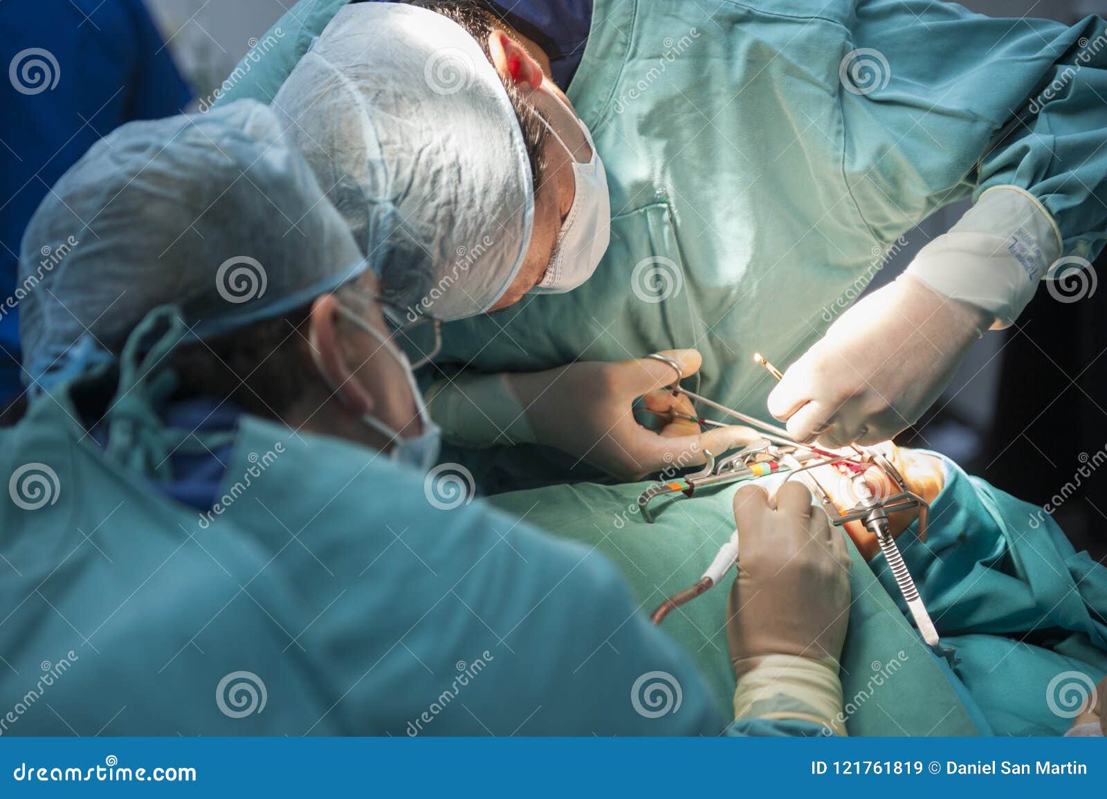 Medici Che Operano Nei Reparti Di Rianimazione Gruppo Di Medici Che Realizza Operazione Immagine Stock Editoriale