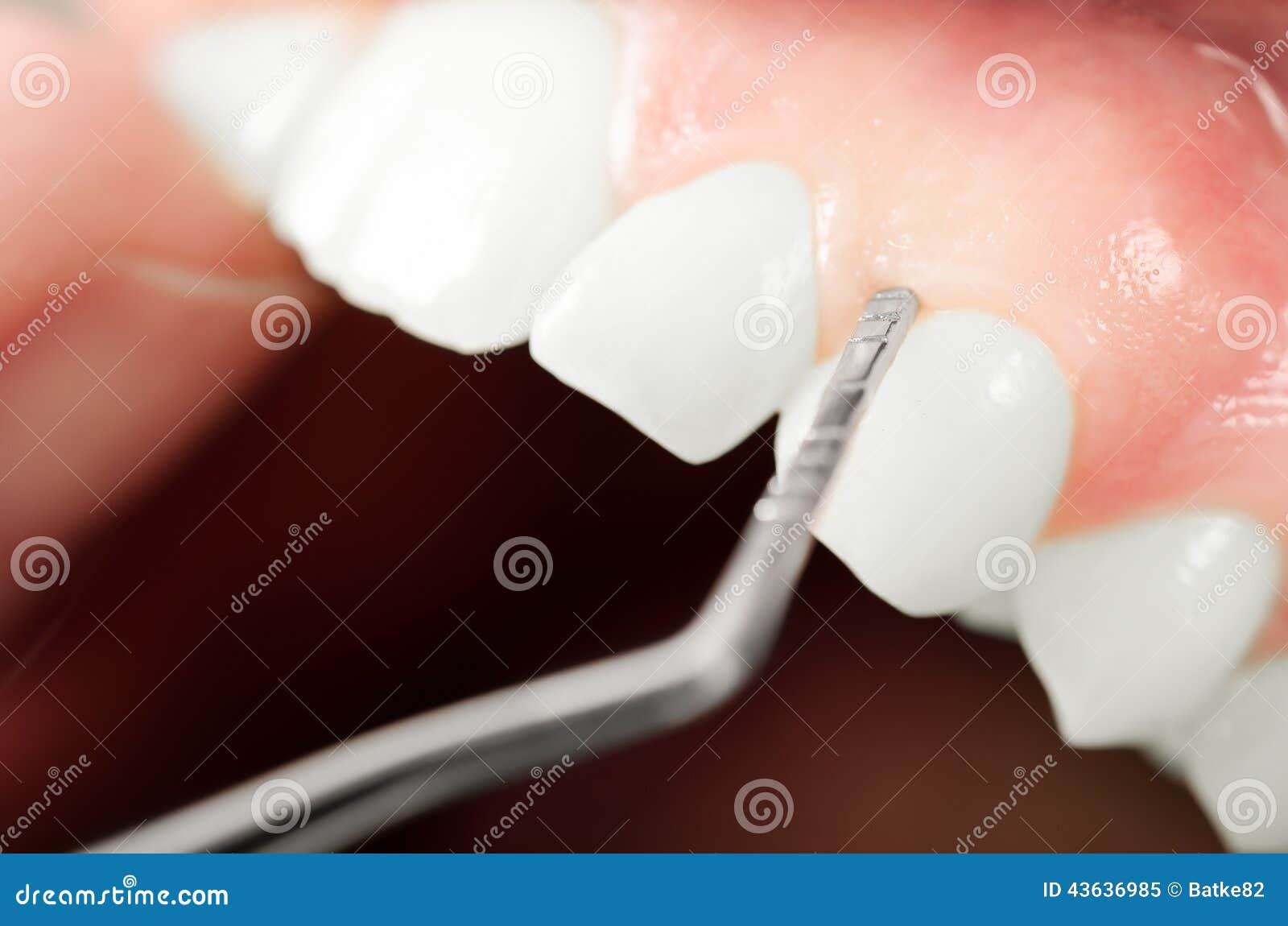 Gums Examination Equipment. Close Up Stock Image Image of caucasian