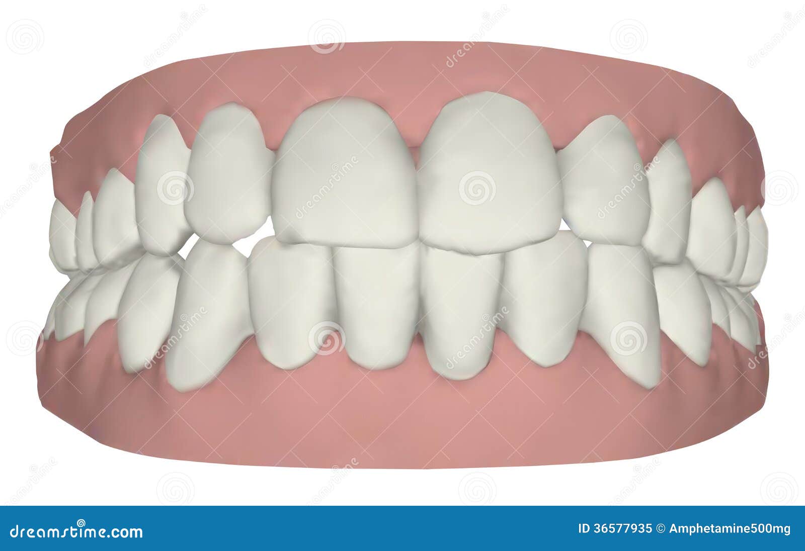 gums and teeth