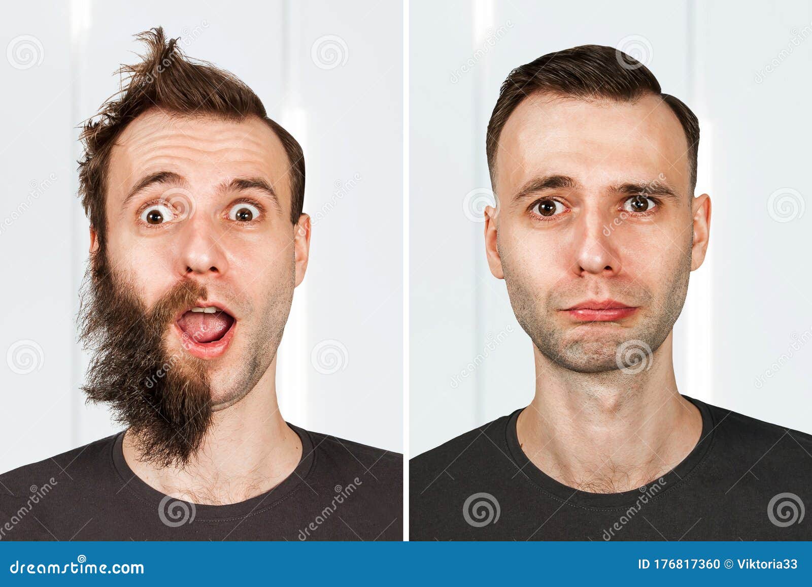 15 Best Beard Styles Without Moustache How to Guide  Examples  The Beard  Struggle
