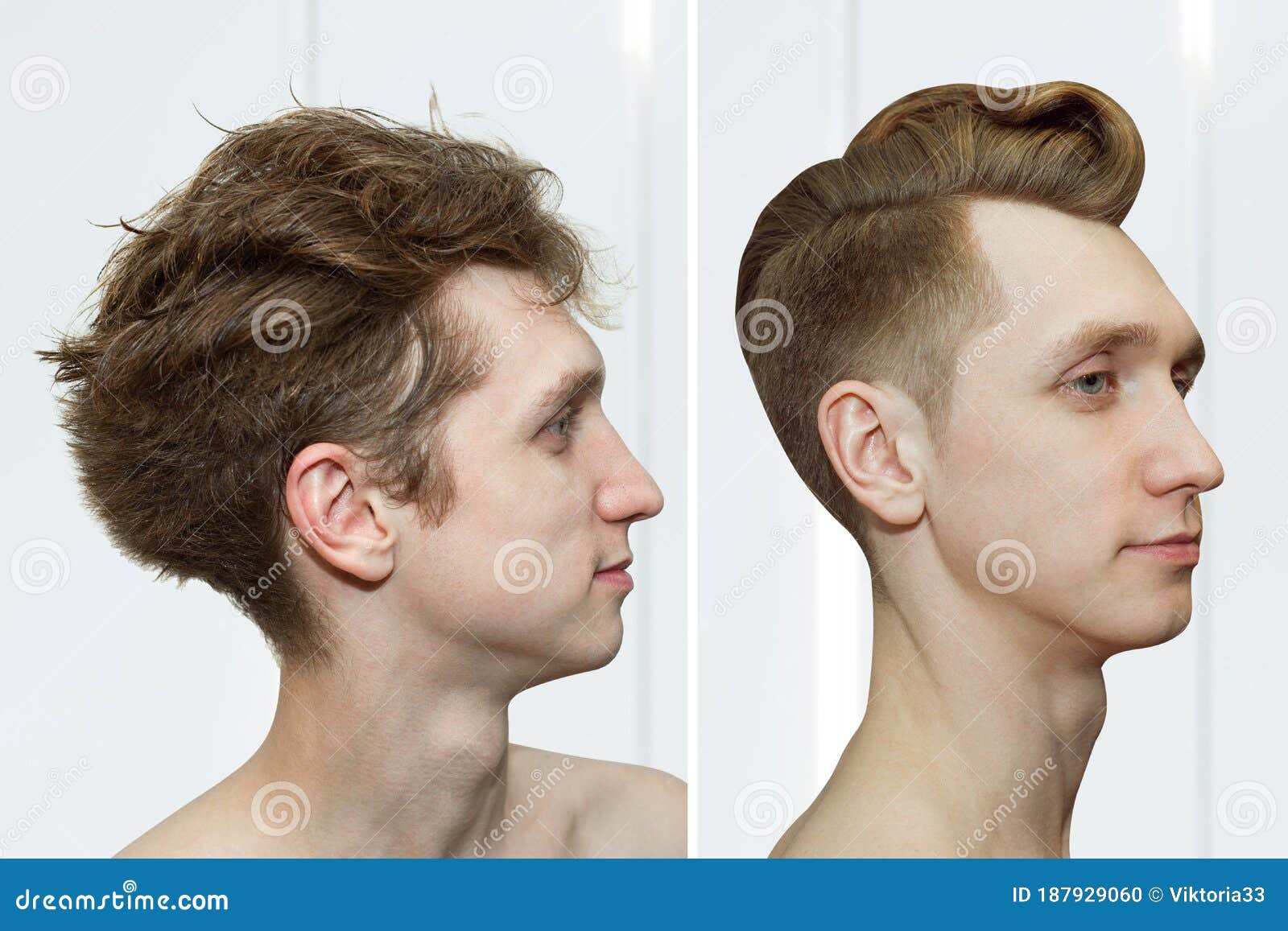 Guy before after Haircut Concept for a Barber Shop: the Problem Man of Hair  Loss, Alopecia, Transplantation Stock Photo - Image of head, concept:  187929060