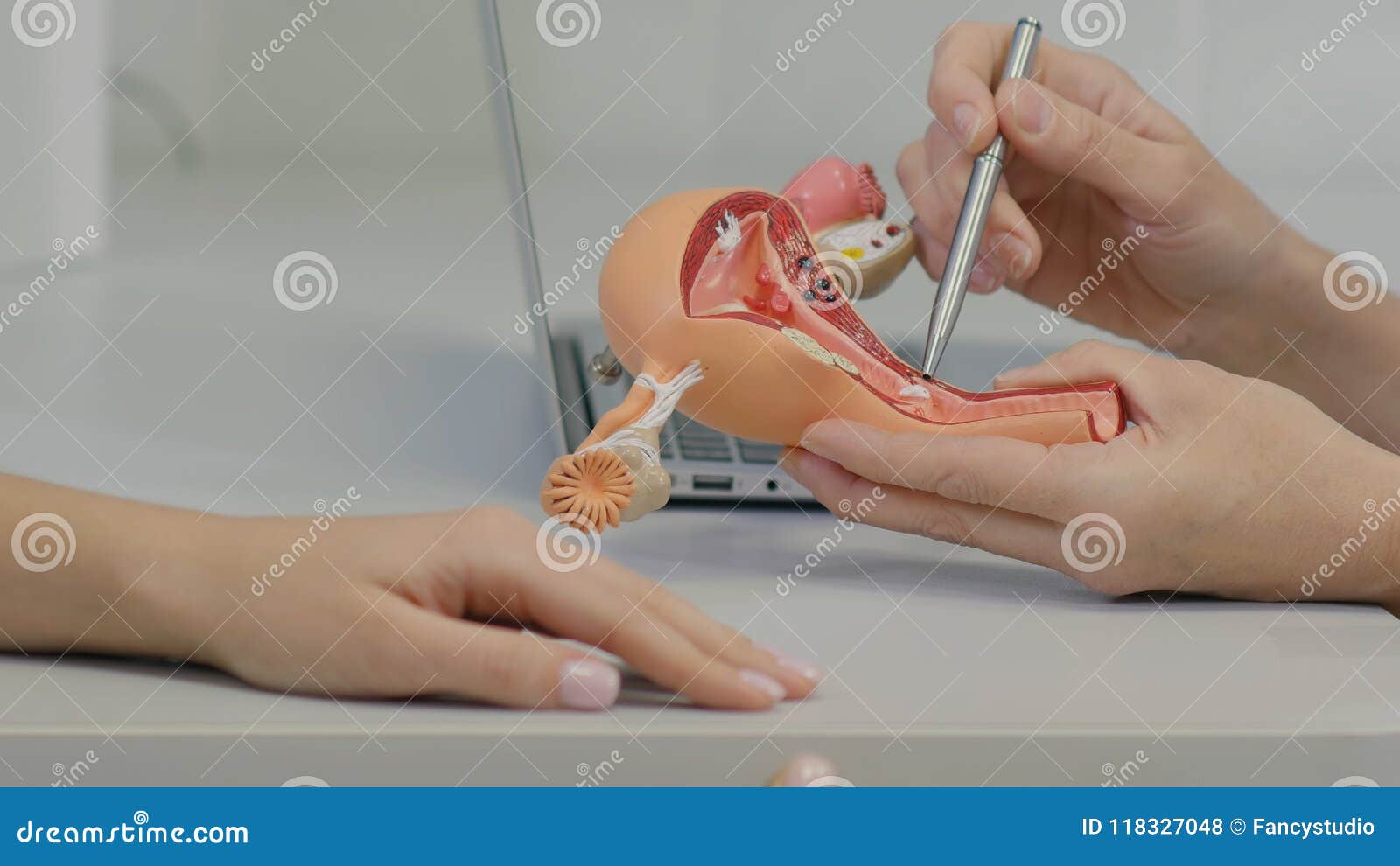 gynecologist doctor consulting patient using uterus anatomy model