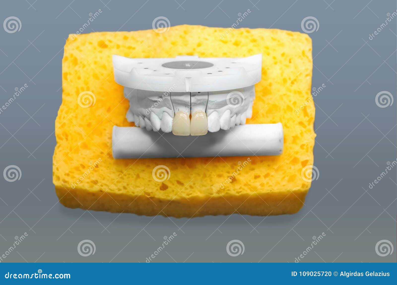 Gypsum Dental Model with Ceramic Teeth Stock Photo Image of medical