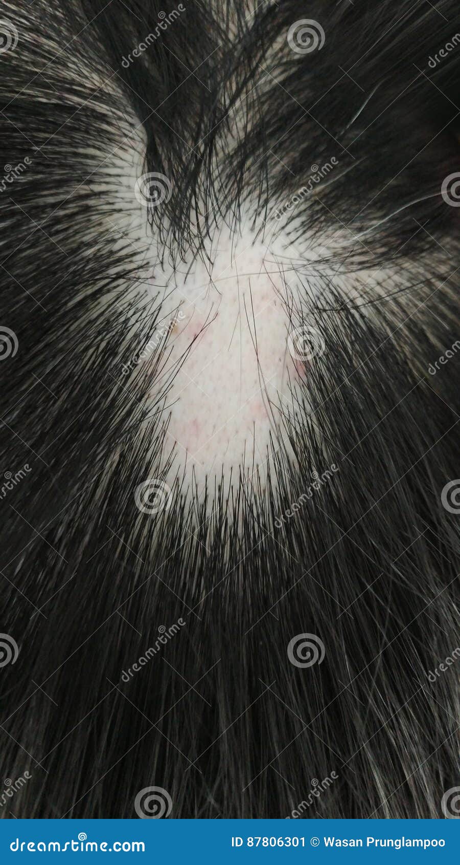 Hair Fall Stock Image Image Of Medical Care Closeup 87806301