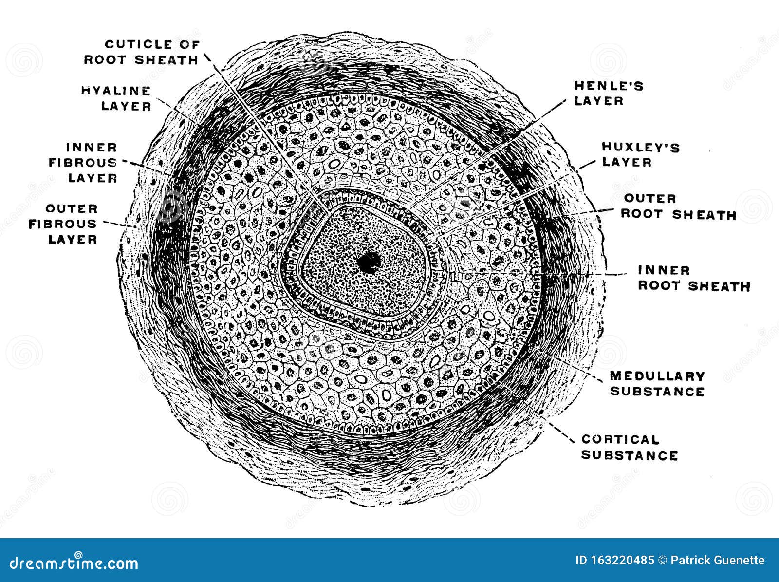 Black Dot Hair Follicle Indian Journal Of Dermatology Venereology And