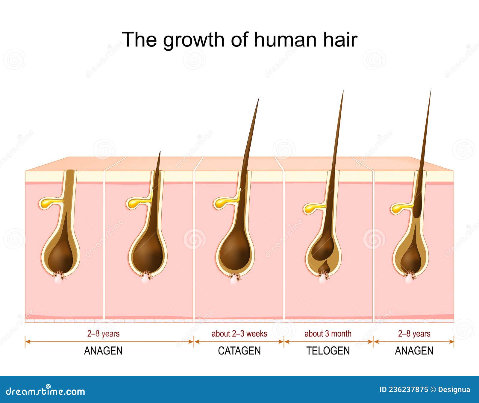 Anagen hair follicles transplanted into mature human scars remodel fibrotic  tissue  npj Regenerative Medicine