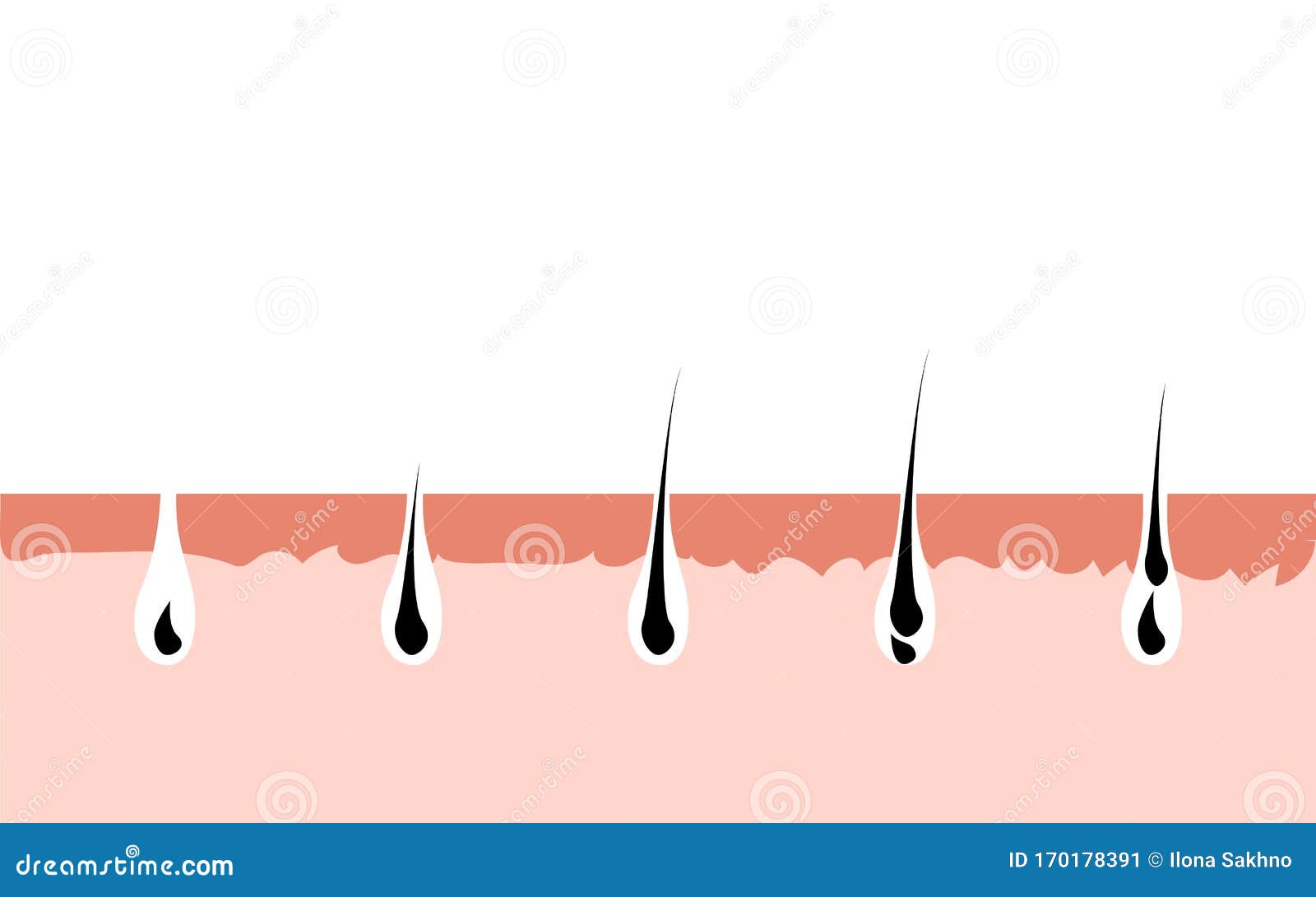 Hair Growth Cycle Skin. Follicle Anatomy Anagen Phase, Hair Growth Diagram  Illustration Stock Vector - Illustration of hormone, loss: 170178391