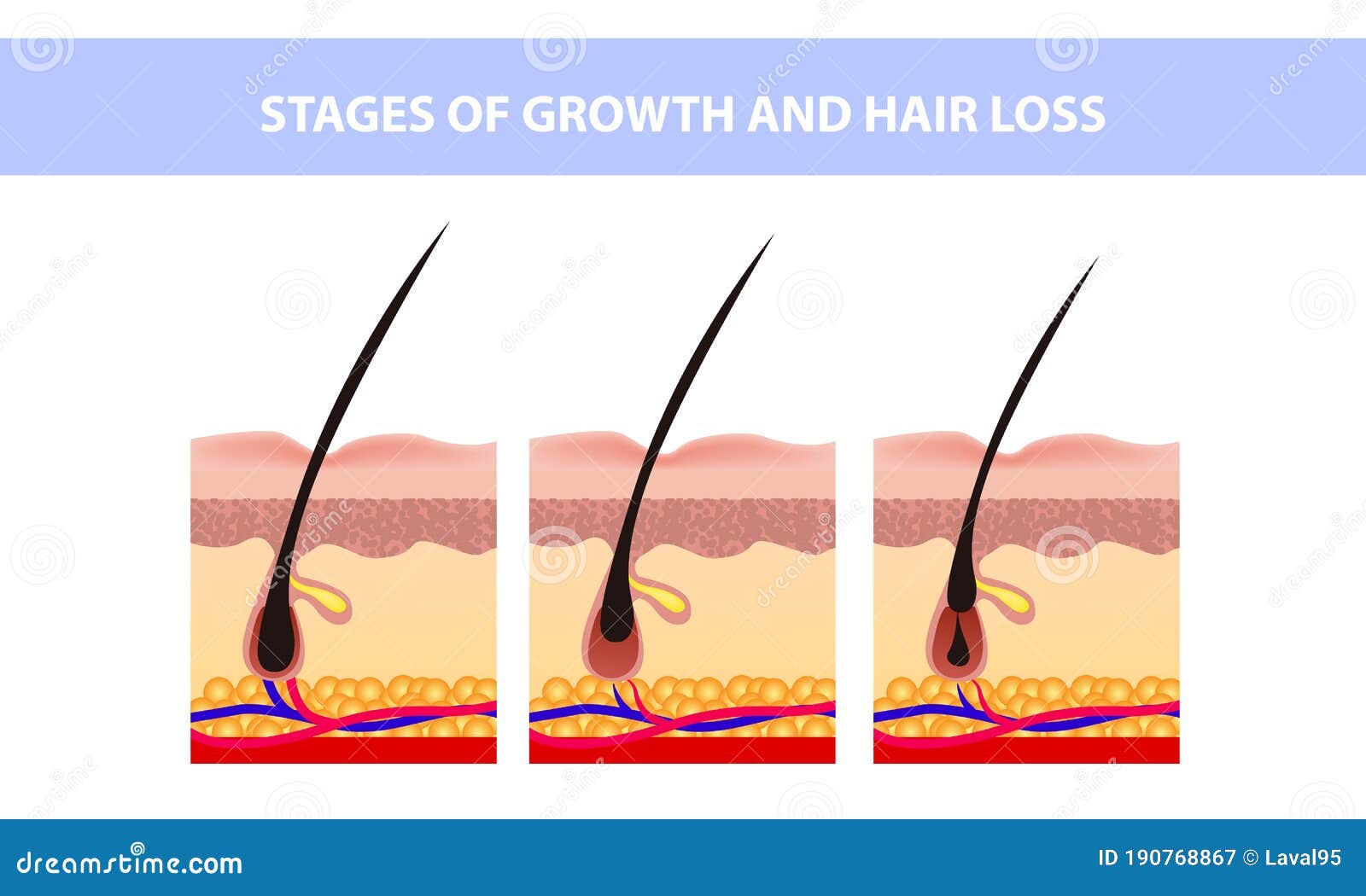 Hair Growth Phase Step by Step. Stages of the Hair Growth Cycle. Anagen, Telogen, Catagen. Anatomy of the Skin Stock Vector - Illustration of medicine, problem: 190768867 Hair Growth Phase Step by Step. Stages of the Hair Growth Cycle. Anagen, Telogen, Catagen. Anatomy of the Skin Stock Vector - Illustration of medicine, problem: 190768867