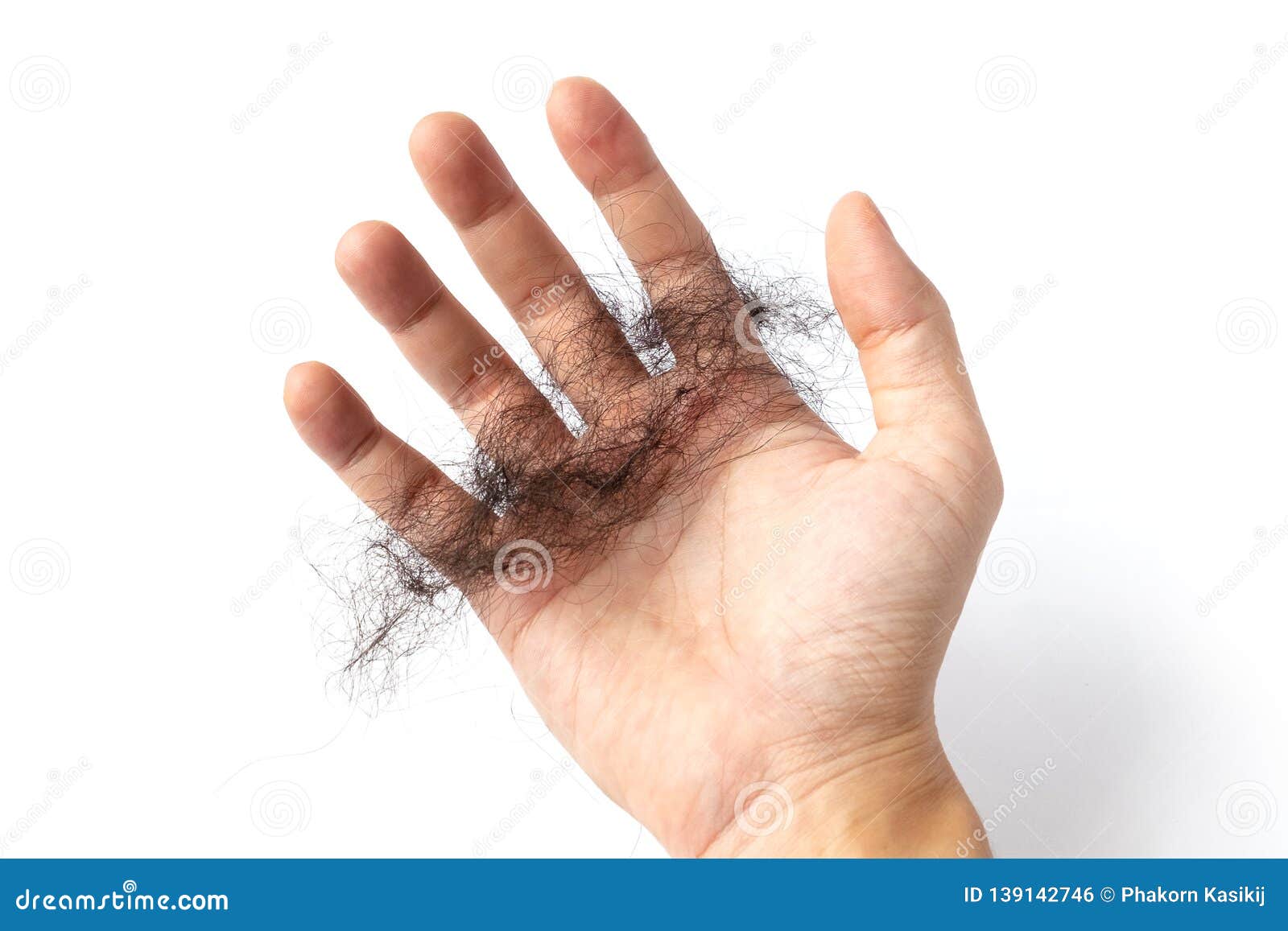 Hair Loss Problem, Closeup of a Hand with Hair Fall on White Background  Stock Photo - Image of long, female: 139142746