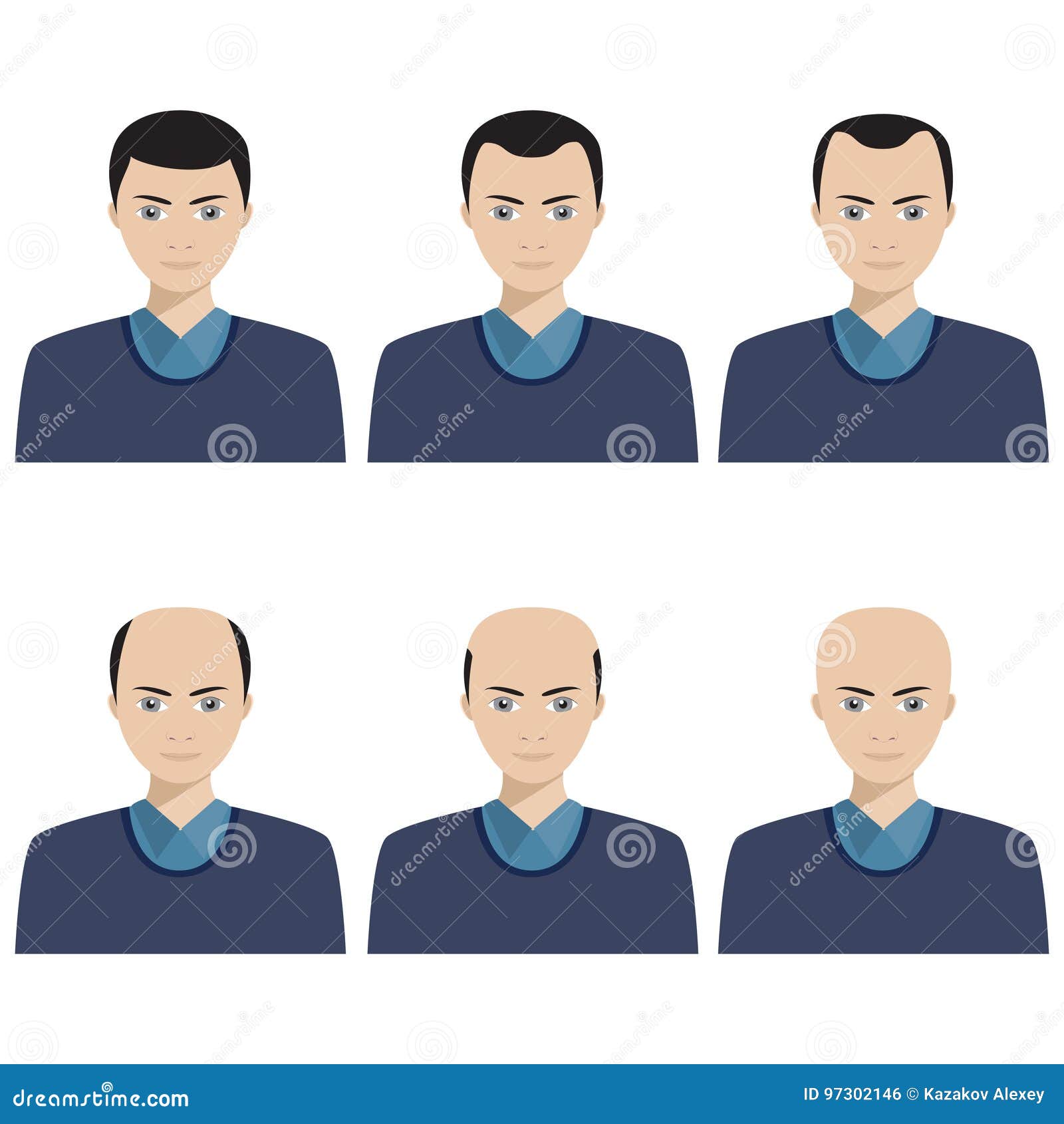 hair loss stages and types of baldness.