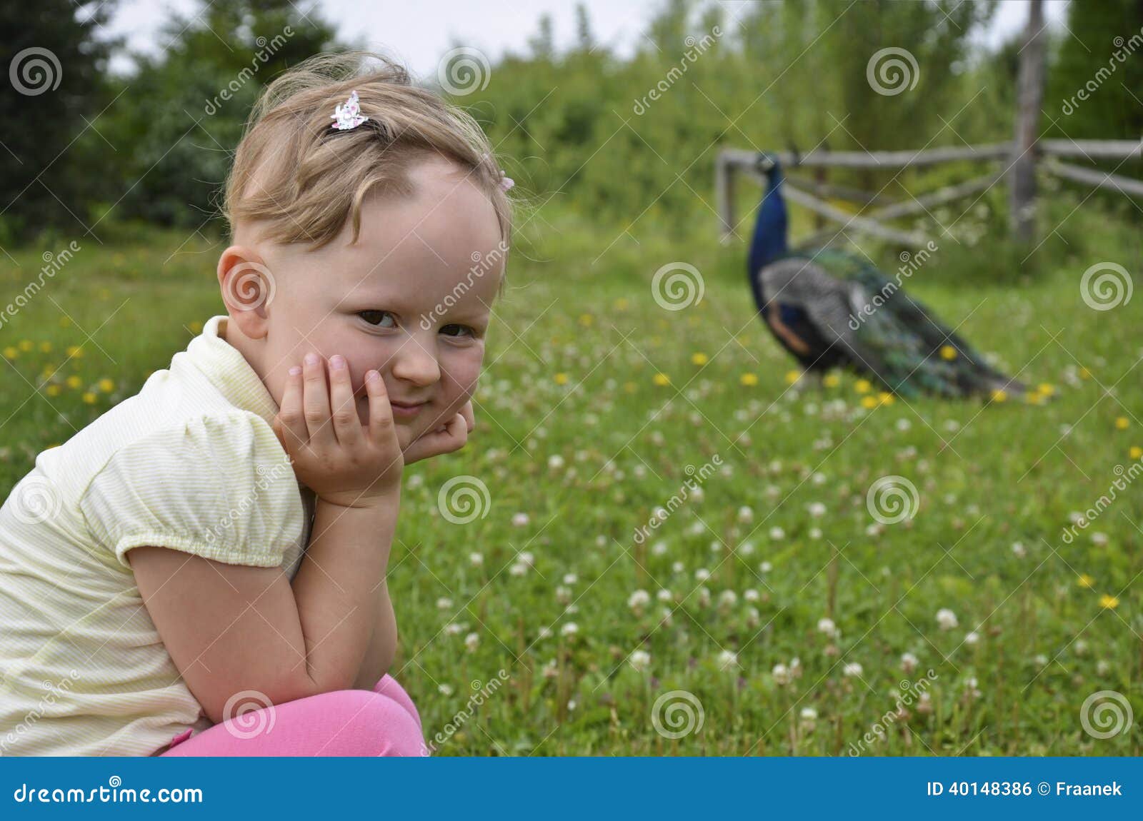 Hair Regrowth In Alopecia Areata In A Child Stock Photo Image