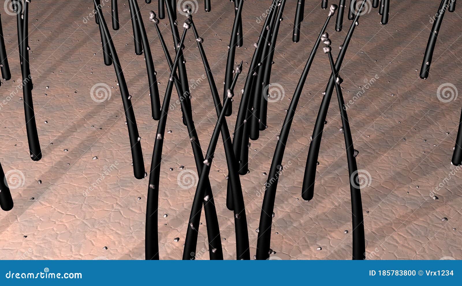 Hair on Skin, Scalp Covered with Dirt Particles, Dandruff, Debris. Close Up  Magnification. View 4. 3d Rendering Illustration Stock Illustration -  Illustration of dandruff, damaged: 185783800