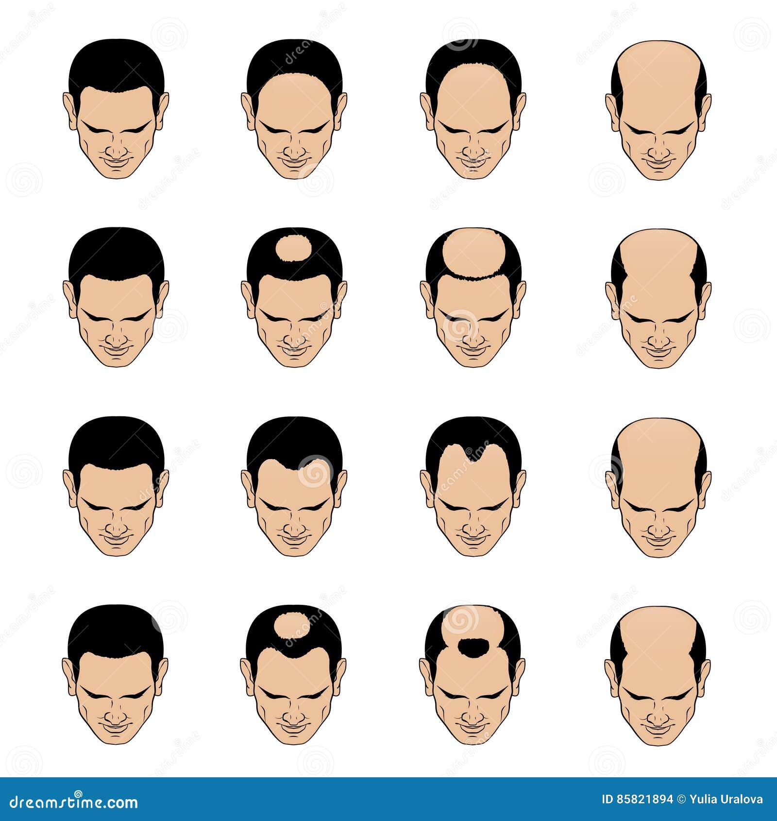 2 - Sumptuary Laws Hairl-loss-patterns-stages-men-information-chart-showing-types-hair-bolding-head-full-hair-cover-to-final-stage-85821894